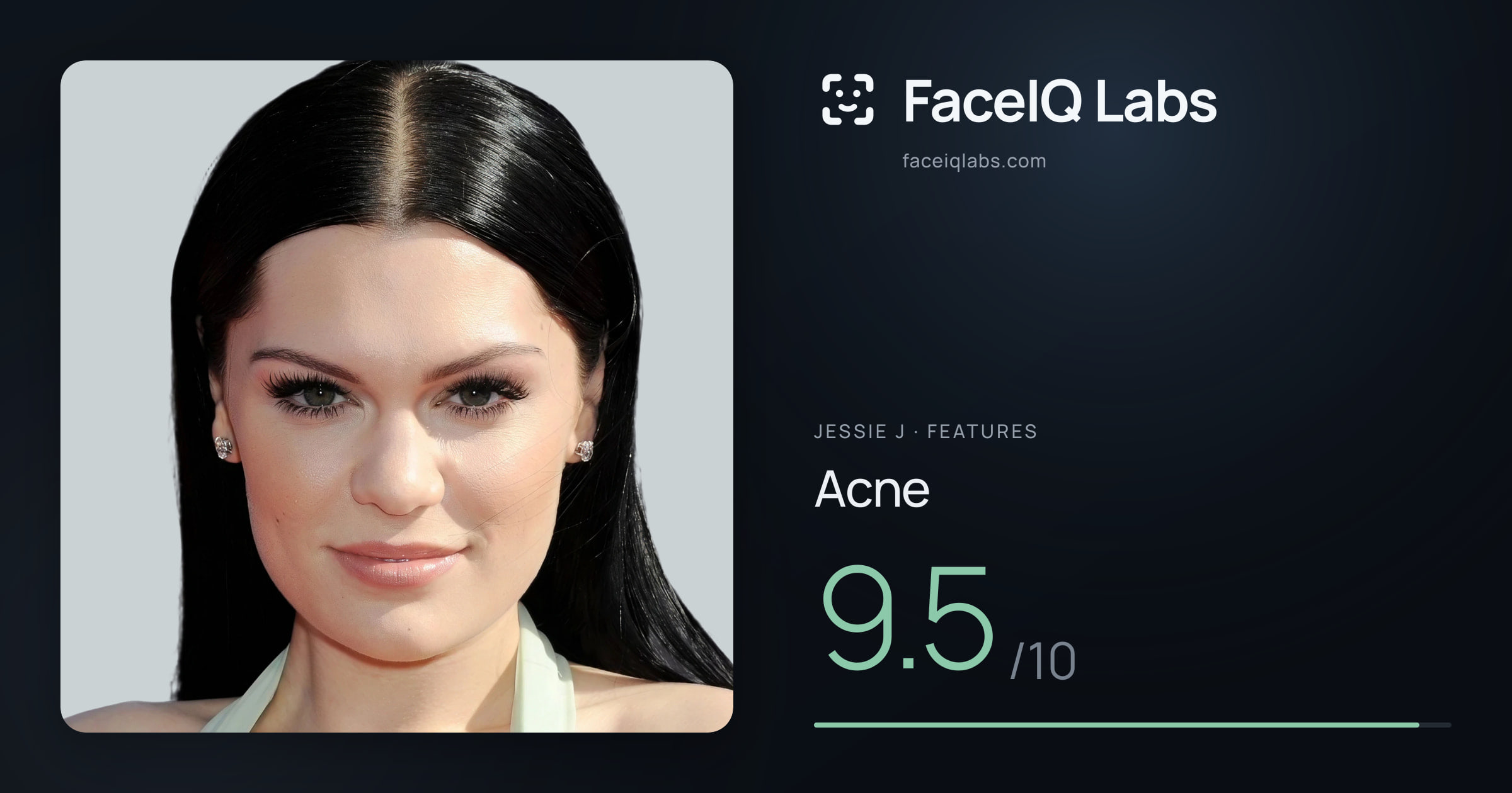 Jessie J Acne: 9.5/10, drawn on the photo