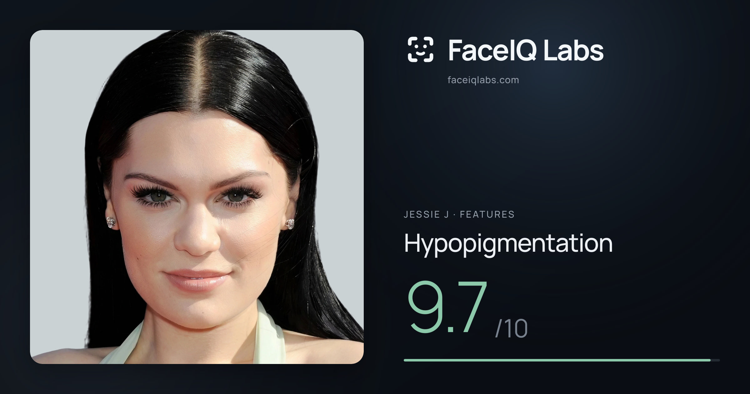 Jessie J Hypopigmentation: 9.7/10, drawn on the photo