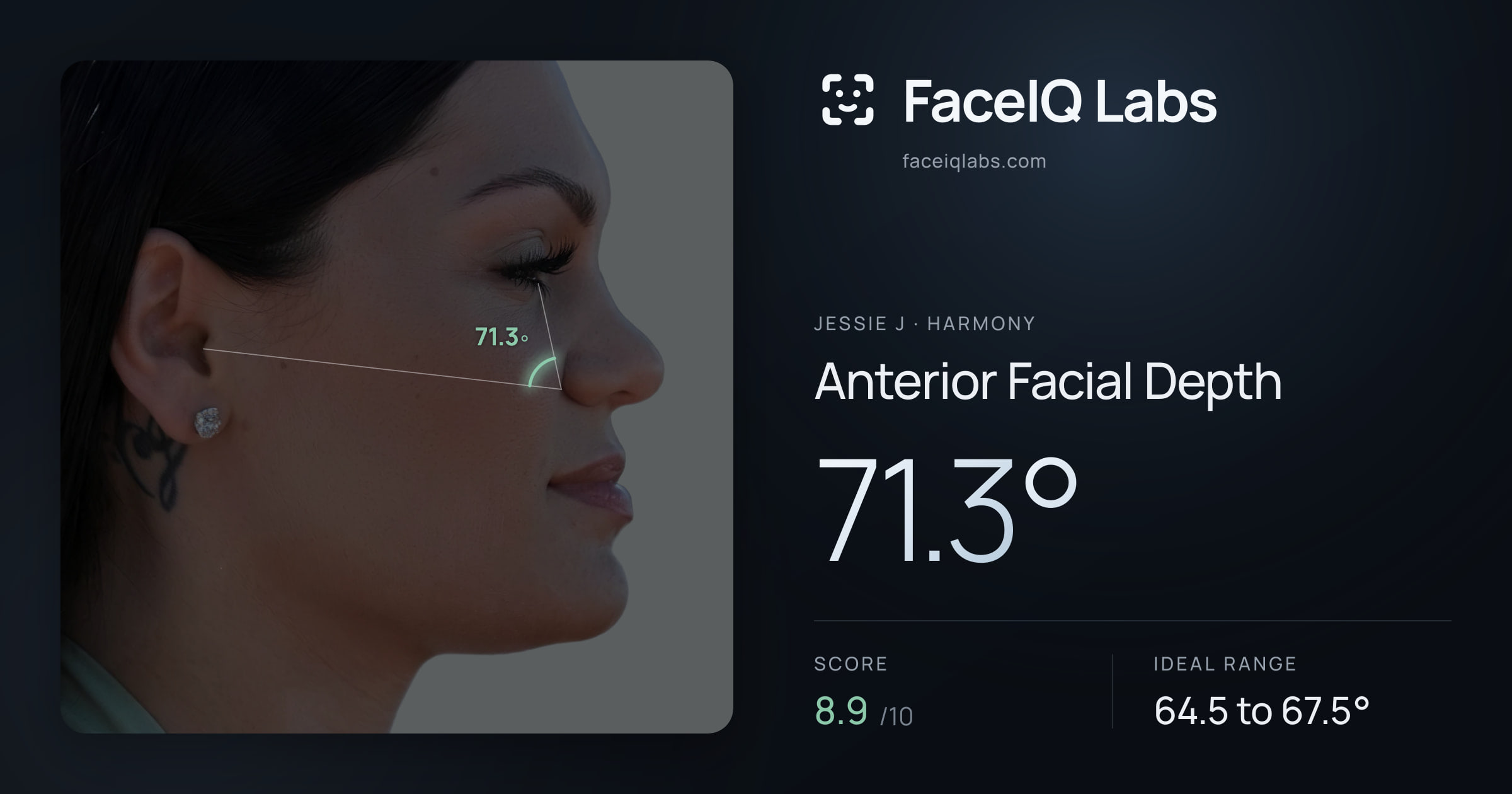 Jessie J Anterior Facial Depth: 71.3°, drawn on the photo