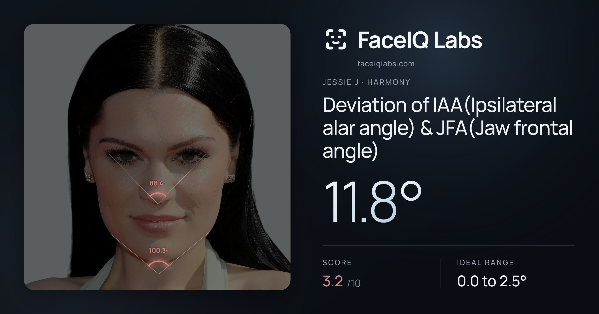Jessie J Deviation of IAA(Ipsilateral alar angle) & JFA(Jaw frontal angle): 11.8°, drawn on the photo