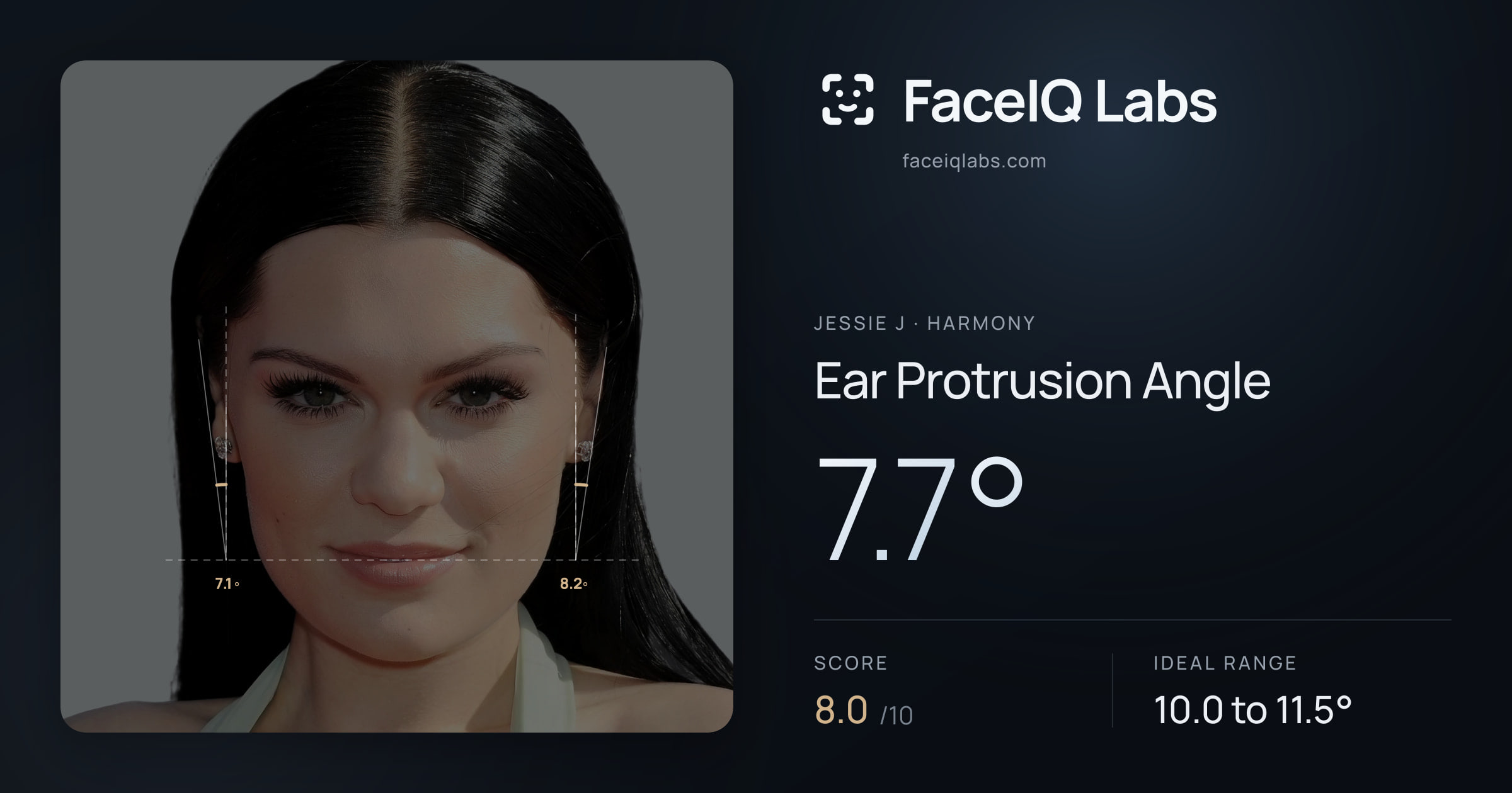 Jessie J Ear Protrusion Angle: 7.7°, drawn on the photo