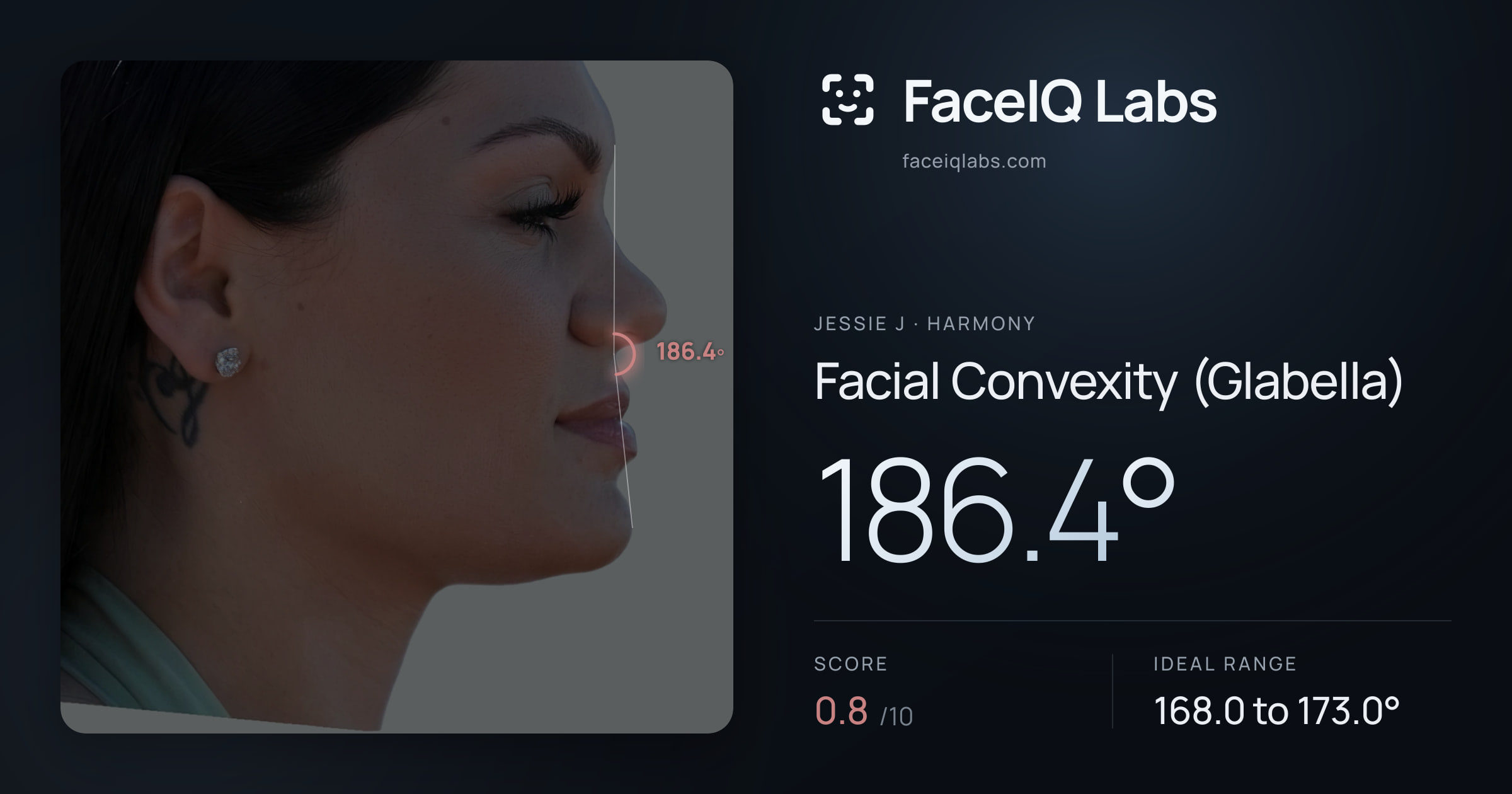 Jessie J Facial Convexity (Glabella): 186.4°, drawn on the photo