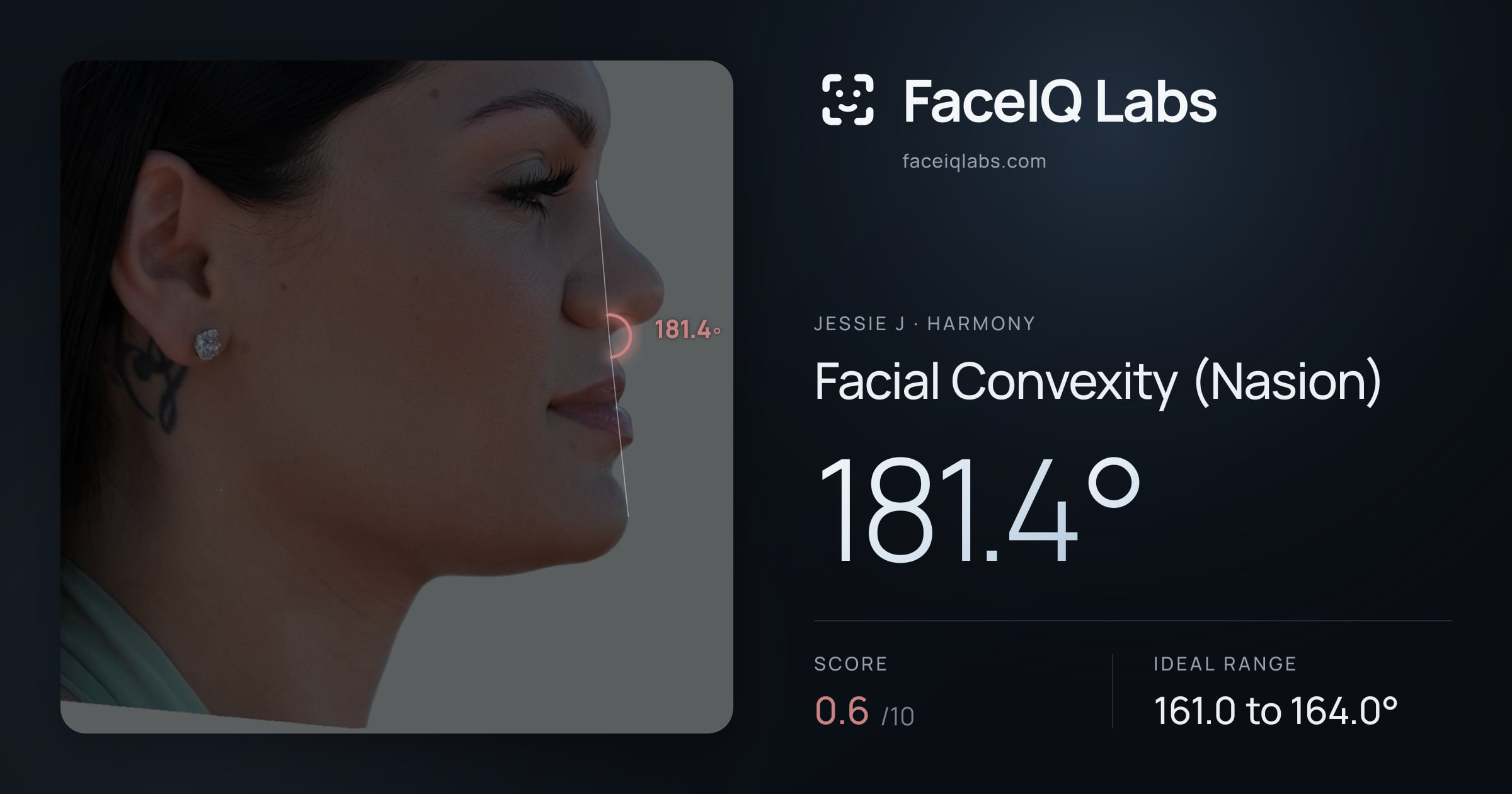 Jessie J Facial Convexity (Nasion): 181.4°, drawn on the photo