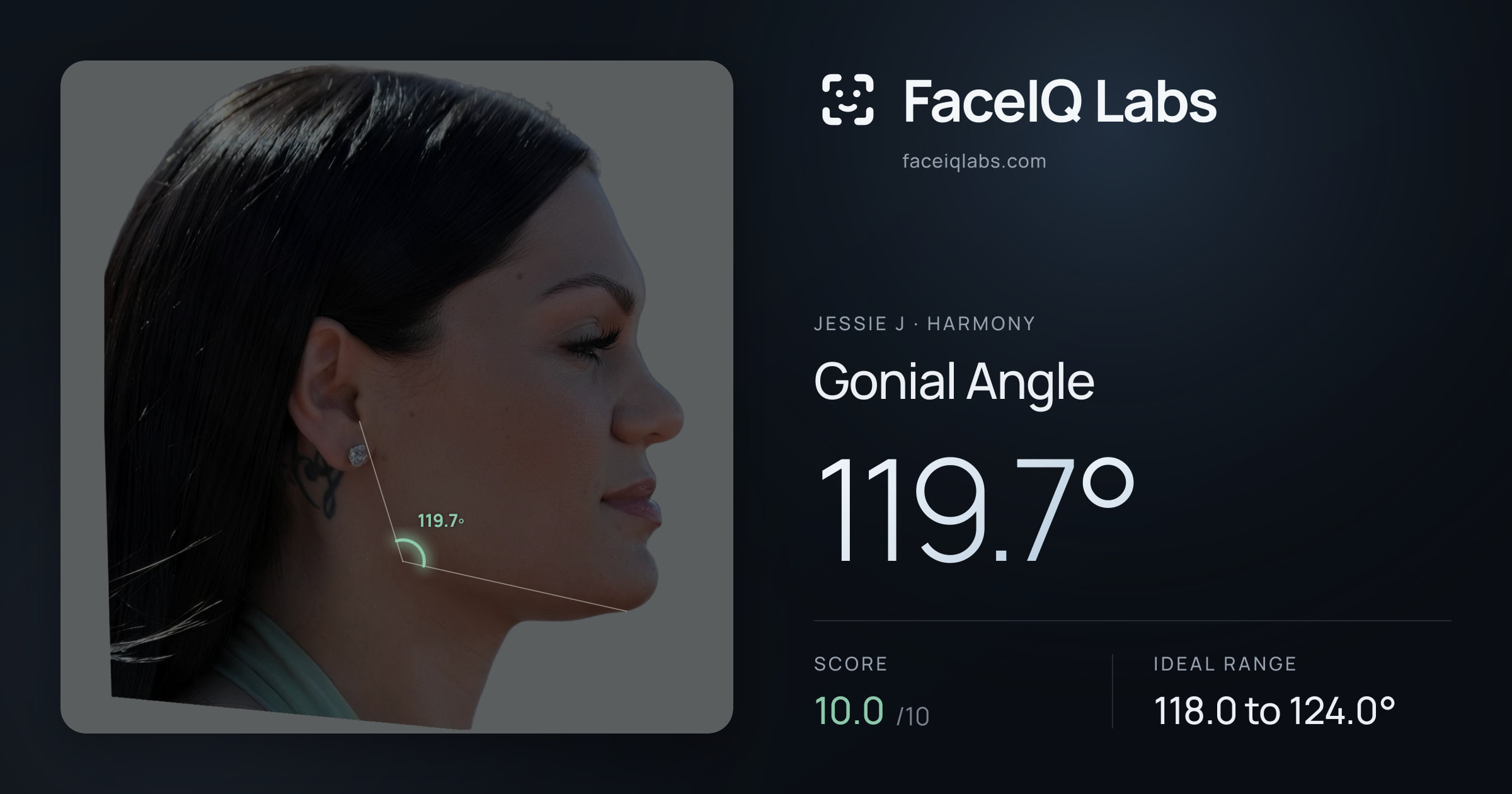 Jessie J Gonial Angle: 119.7°, drawn on the photo