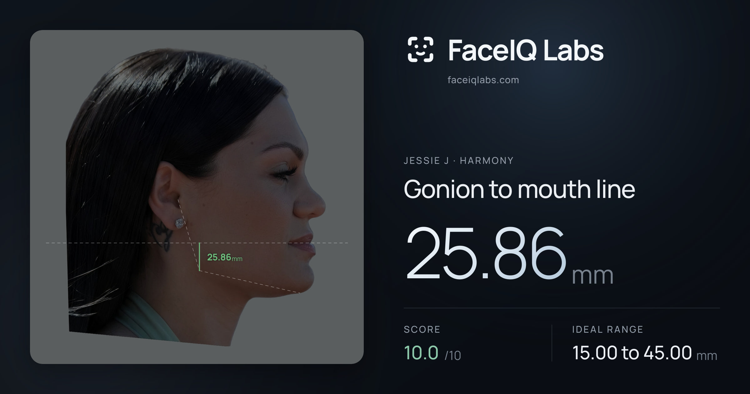 Jessie J Gonion to mouth line: 25.86mm, drawn on the photo