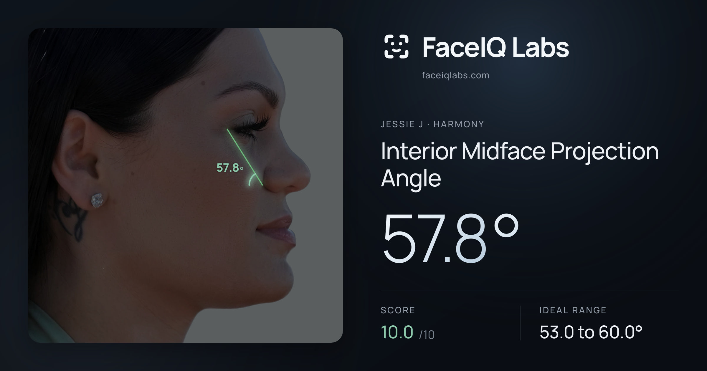 Jessie J Interior Midface Projection Angle: 57.8°, drawn on the photo
