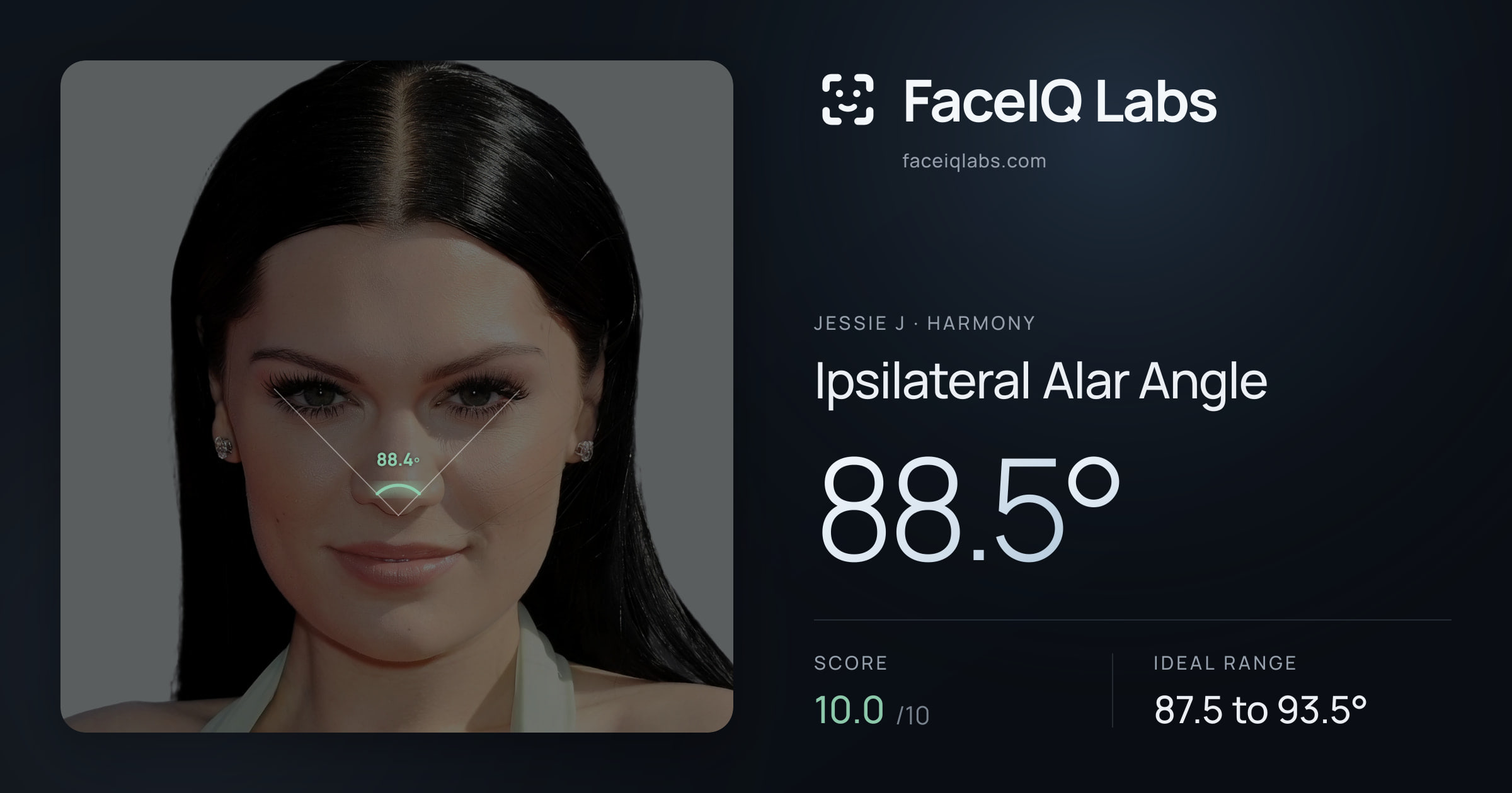 Jessie J Ipsilateral Alar Angle: 88.5°, drawn on the photo