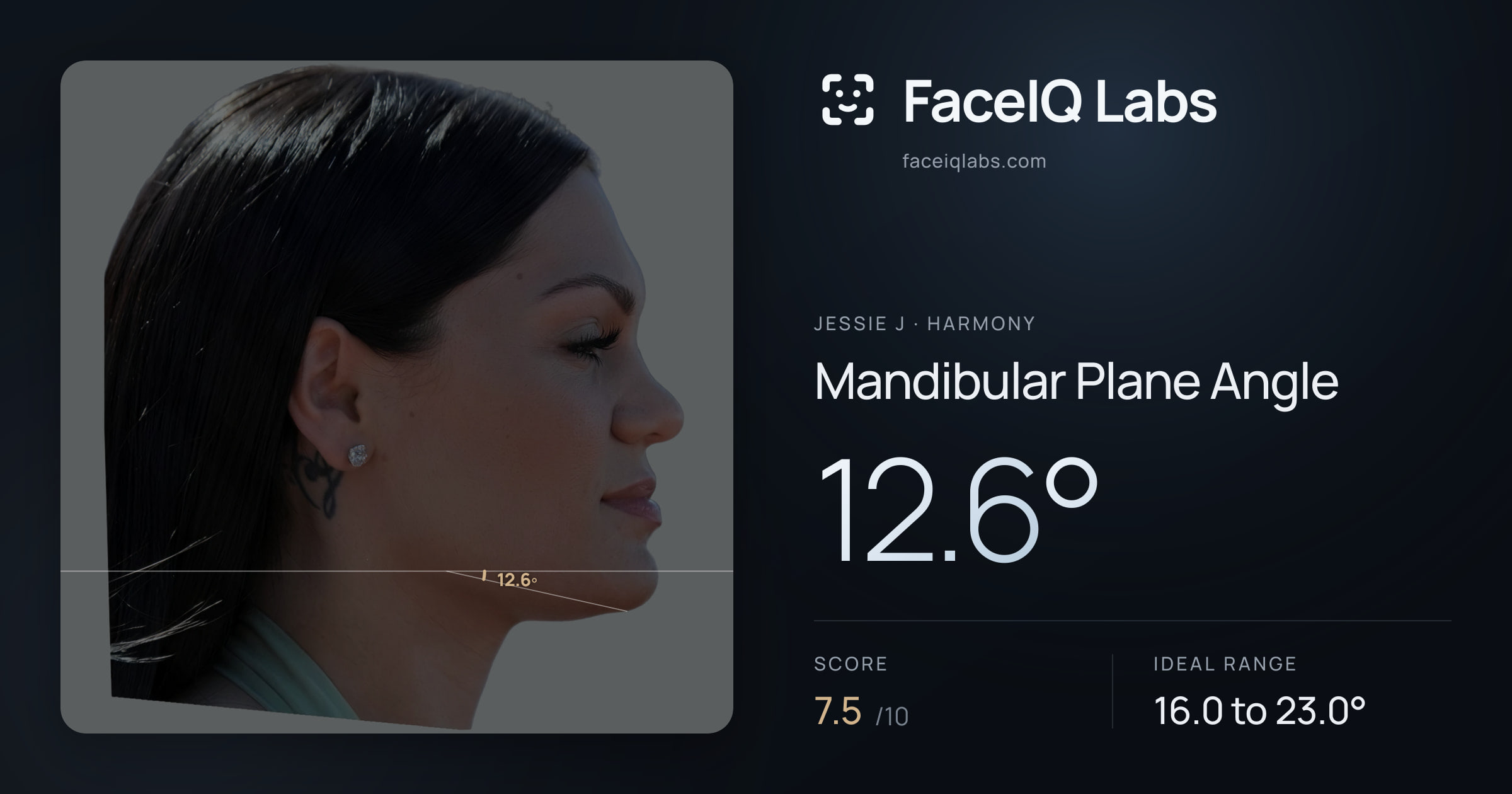 Jessie J Mandibular Plane Angle: 12.6°, drawn on the photo