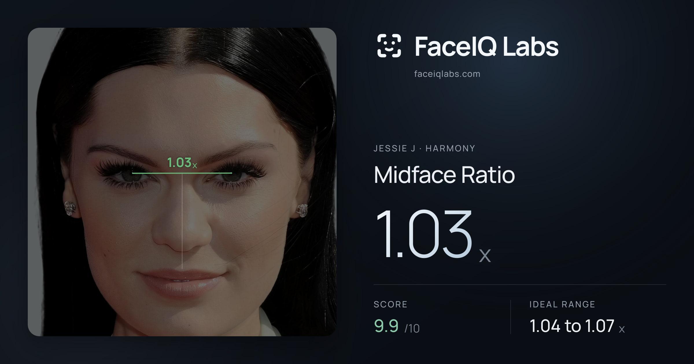 Jessie J Midface Ratio: 1.03x, drawn on the photo