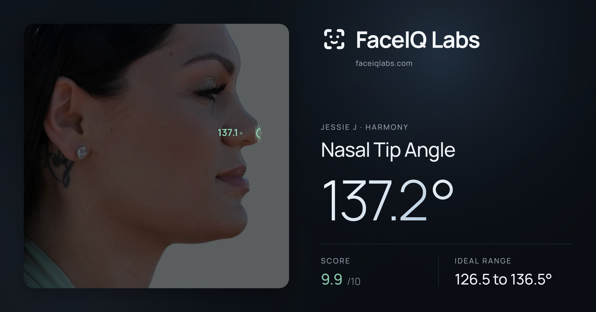 Jessie J Nasal Tip Angle: 137.2°, drawn on the photo
