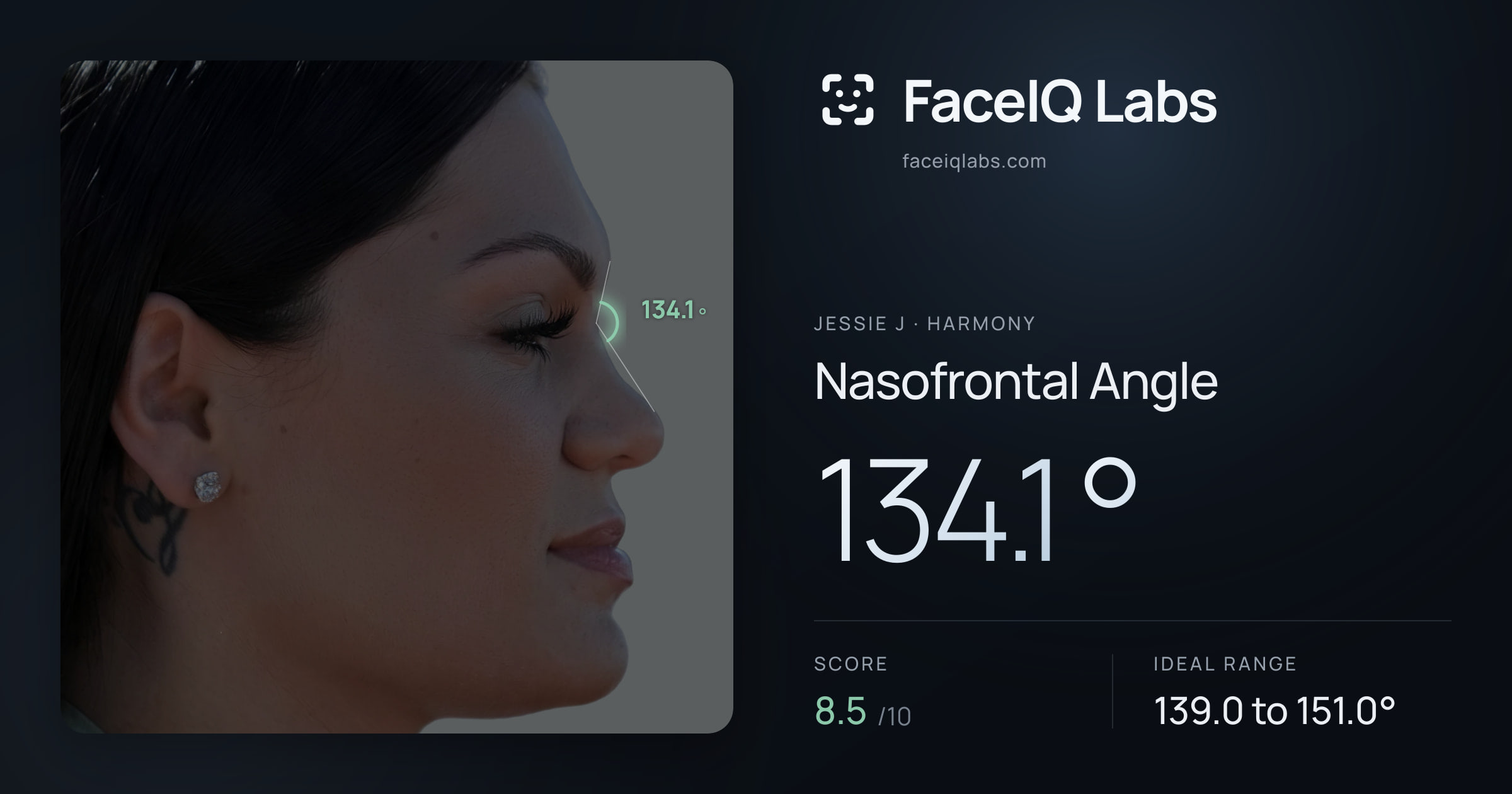 Jessie J Nasofrontal Angle: 134.1°, drawn on the photo