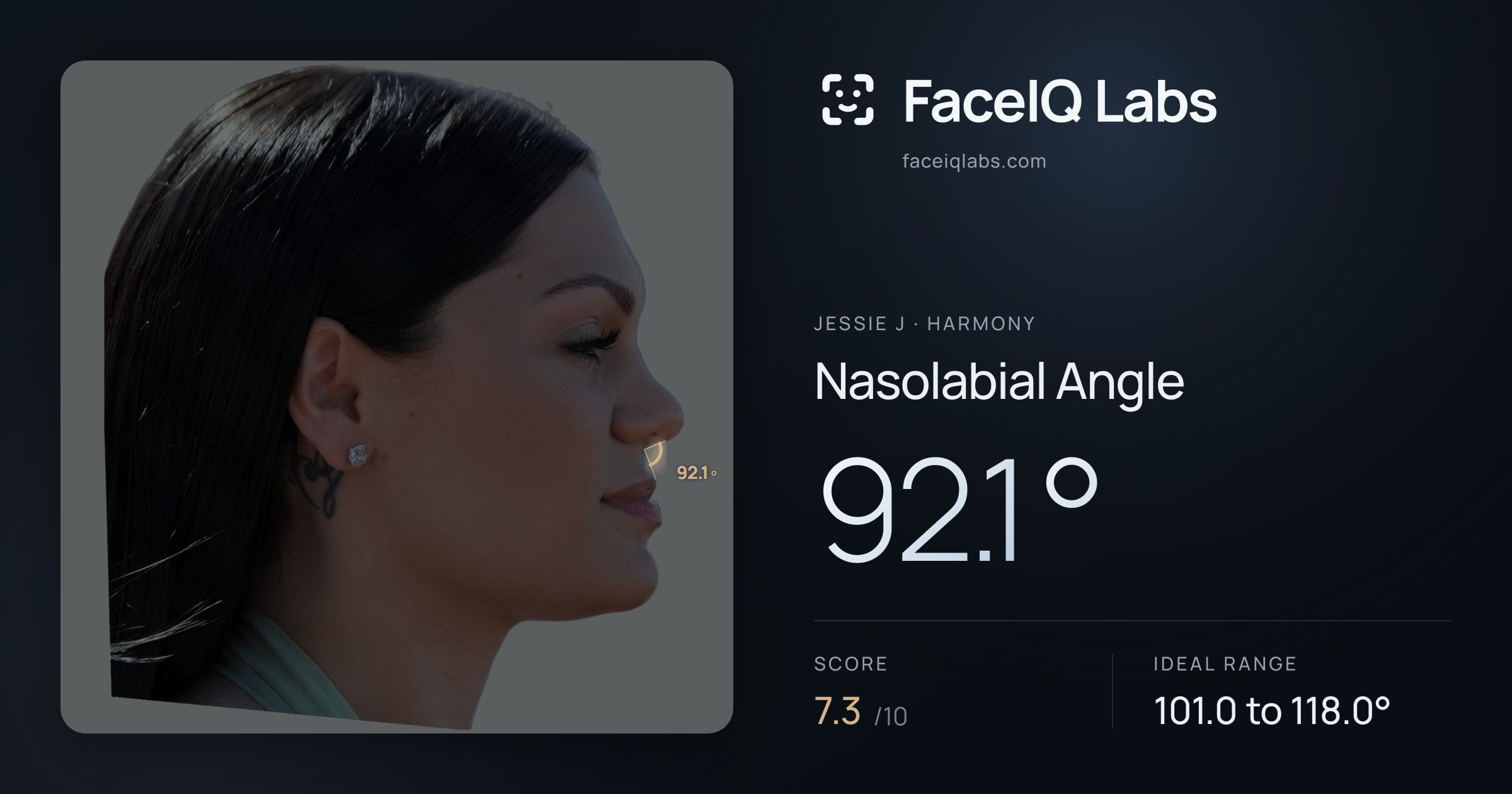 Jessie J Nasolabial Angle: 92.1°, drawn on the photo