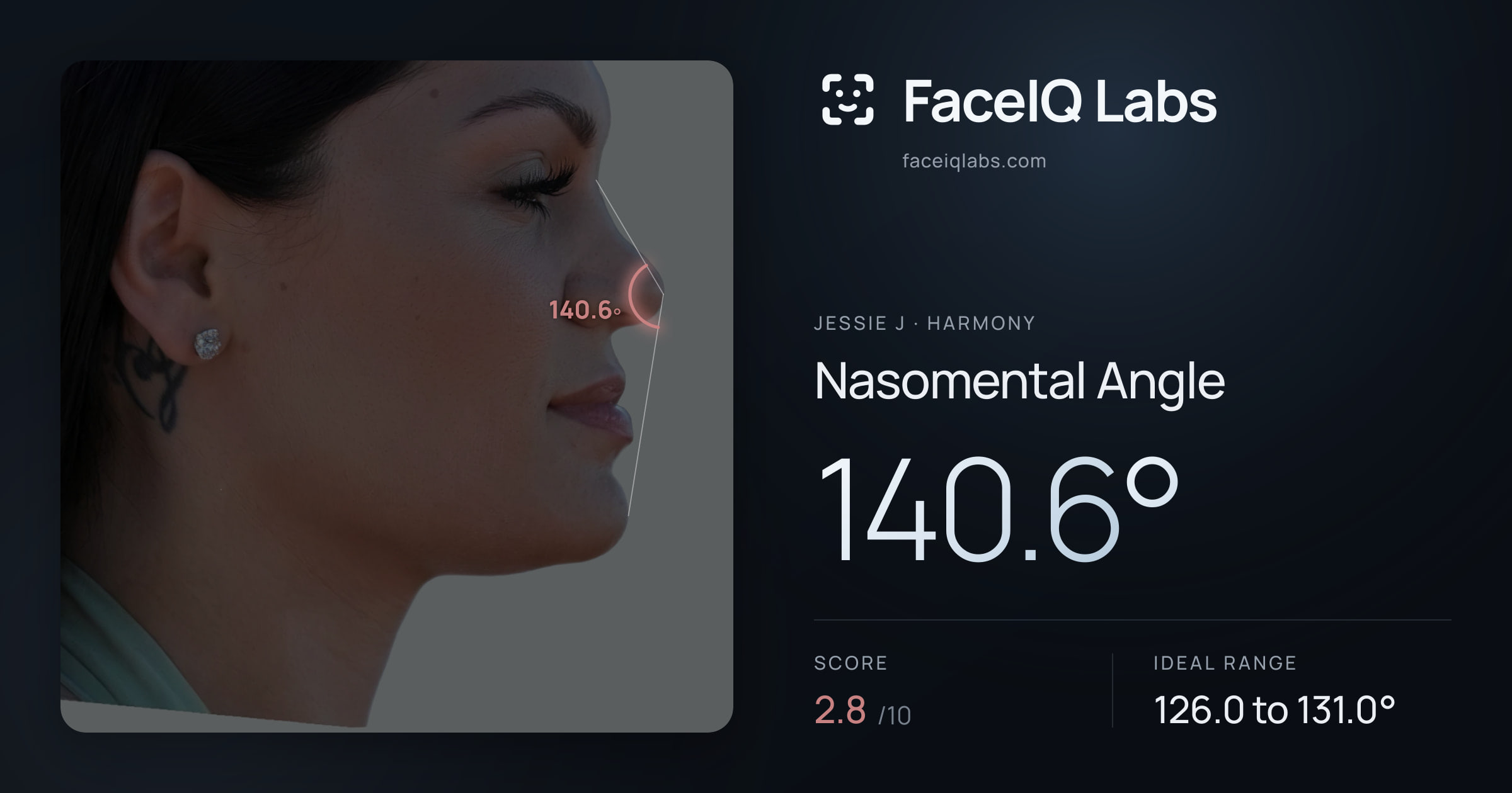 Jessie J Nasomental Angle: 140.6°, drawn on the photo