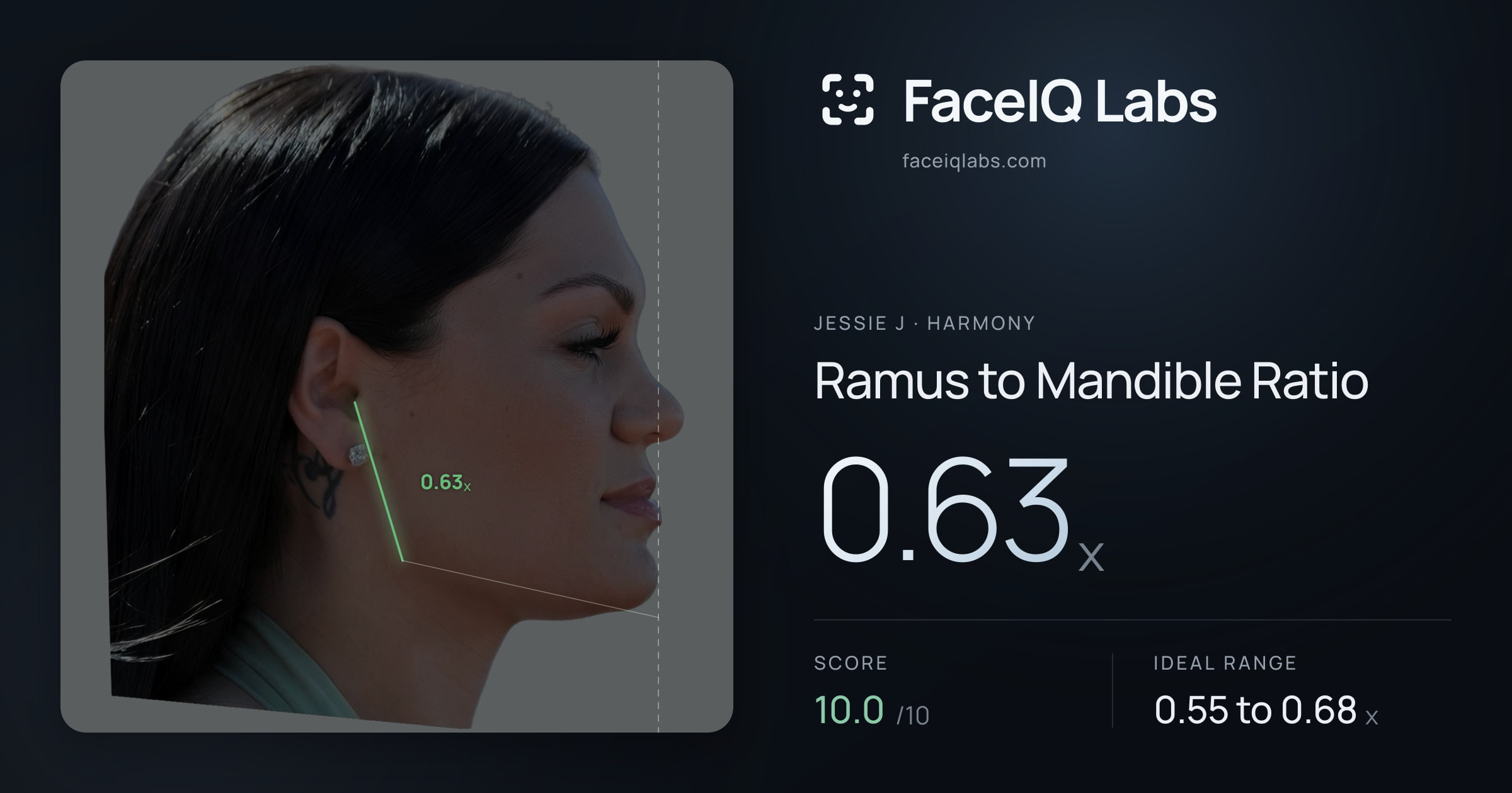 Jessie J Ramus to Mandible Ratio: 0.63x, drawn on the photo