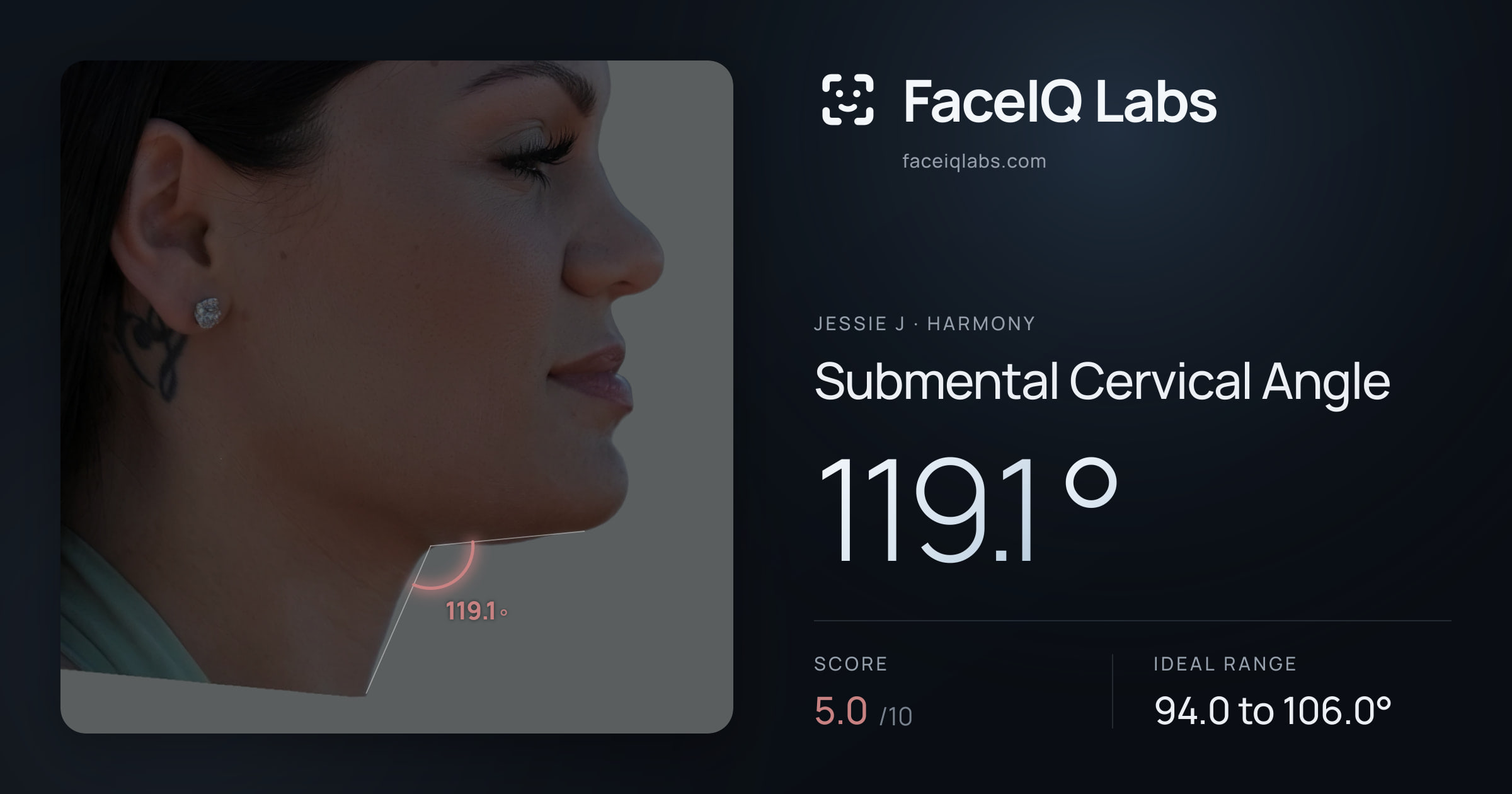 Jessie J Submental Cervical Angle: 119.1°, drawn on the photo