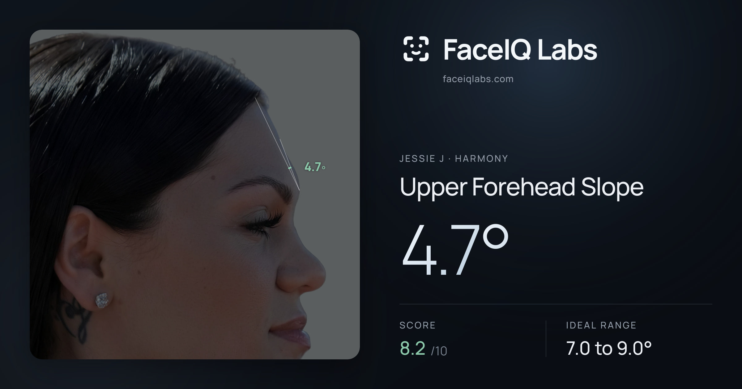 Jessie J Upper Forehead Slope: 4.7°, drawn on the photo