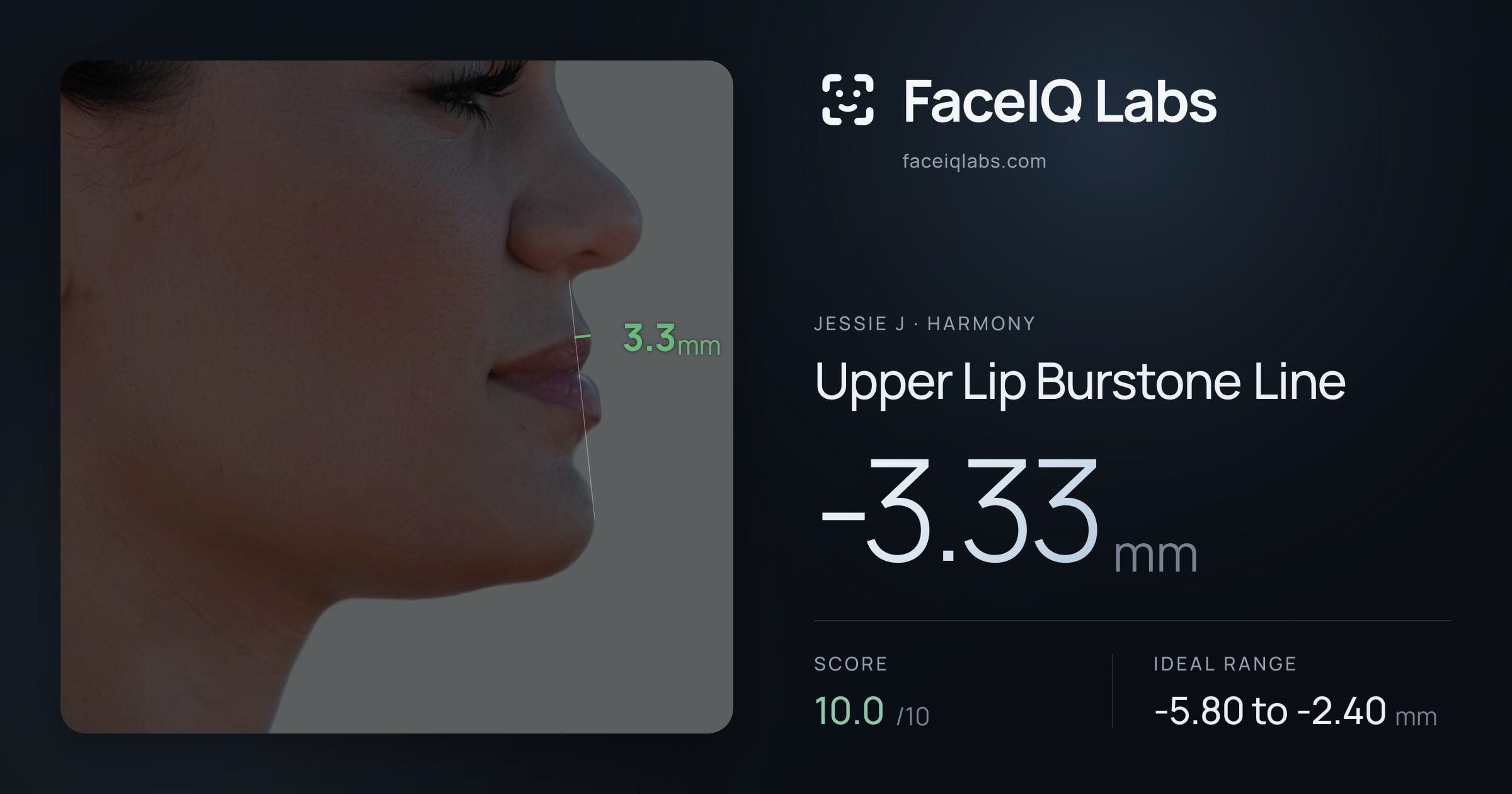 Jessie J Upper Lip Burstone Line: -3.33mm, drawn on the photo