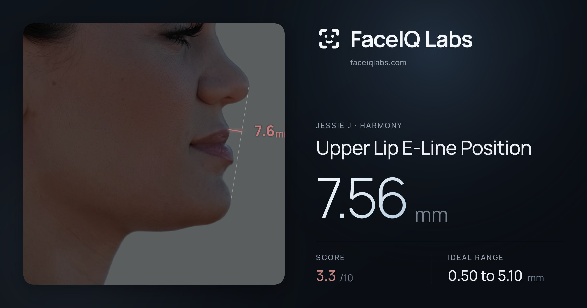 Jessie J Upper Lip E-Line Position: 7.56mm, drawn on the photo
