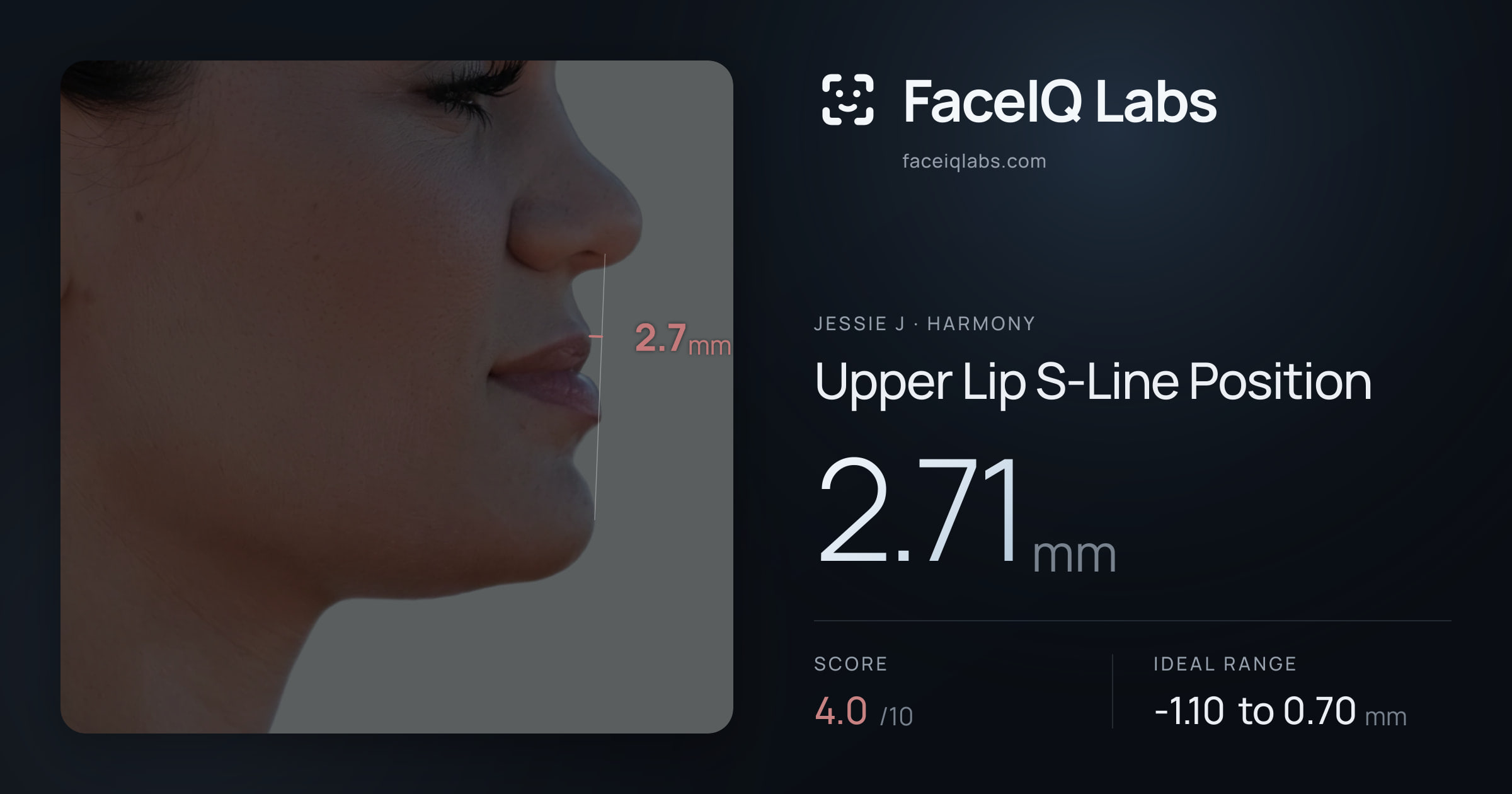 Jessie J Upper Lip S-Line Position: 2.71mm, drawn on the photo