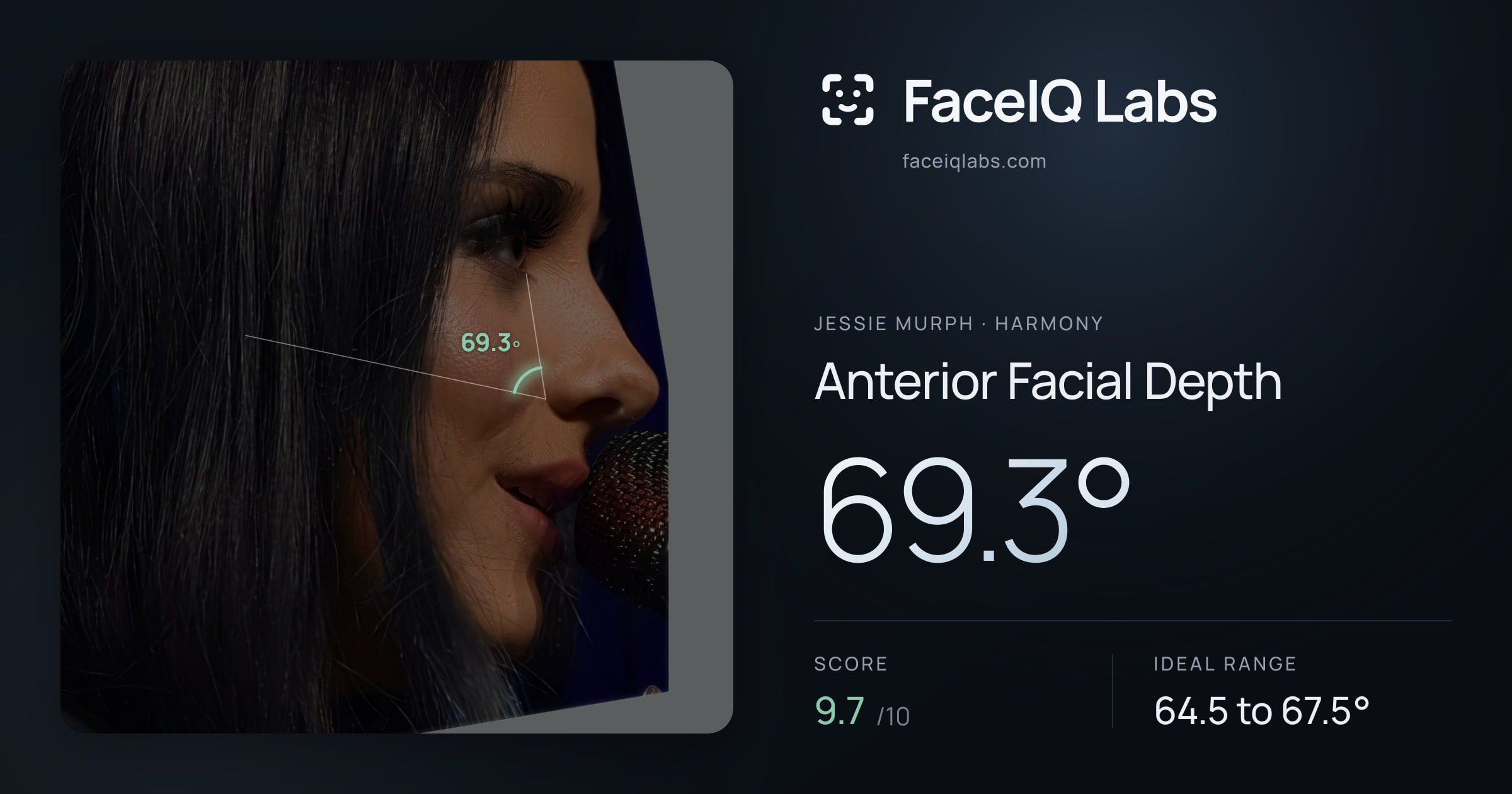 Jessie Murph Anterior Facial Depth: 69.3°, drawn on the photo