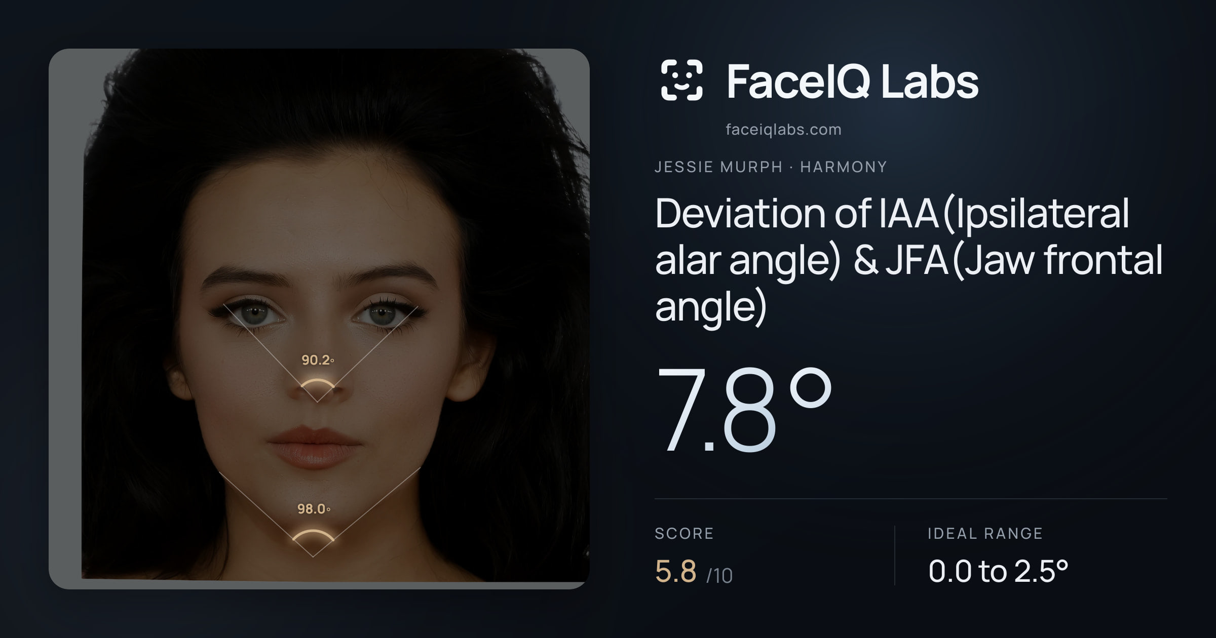 Jessie Murph Deviation of IAA(Ipsilateral alar angle) & JFA(Jaw frontal angle): 7.8°, drawn on the photo