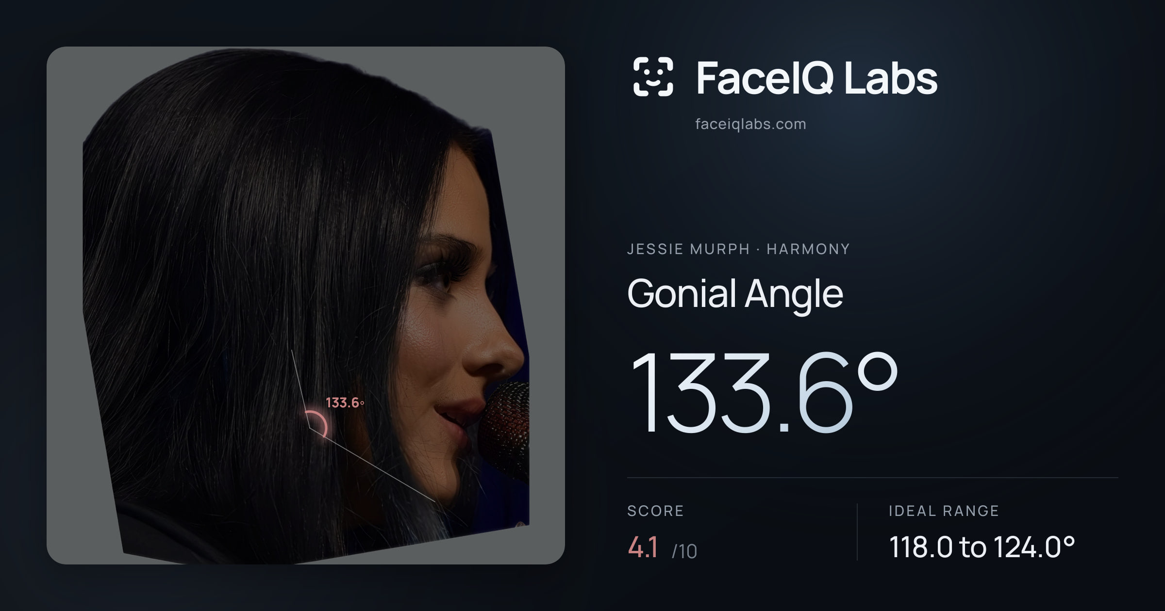 Jessie Murph Gonial Angle: 133.6°, drawn on the photo