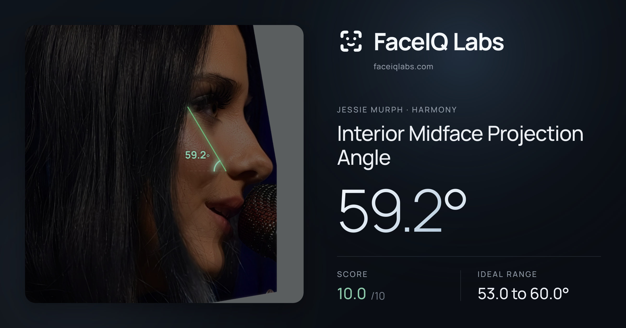 Jessie Murph Interior Midface Projection Angle: 59.2°, drawn on the photo