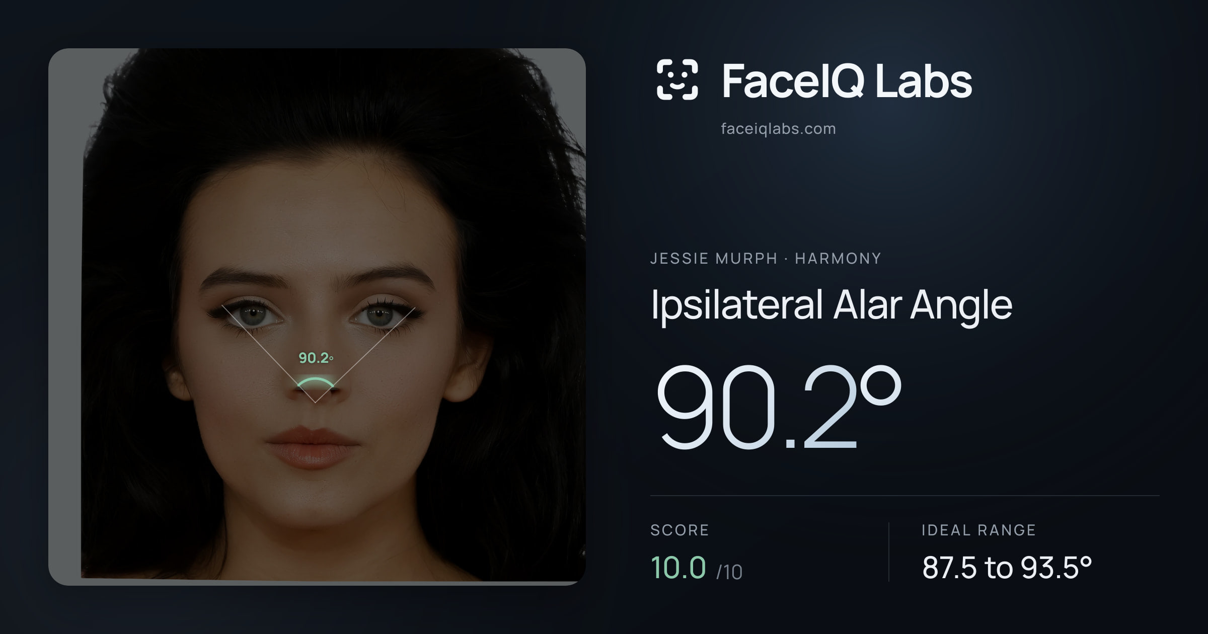 Jessie Murph Ipsilateral Alar Angle: 90.2°, drawn on the photo