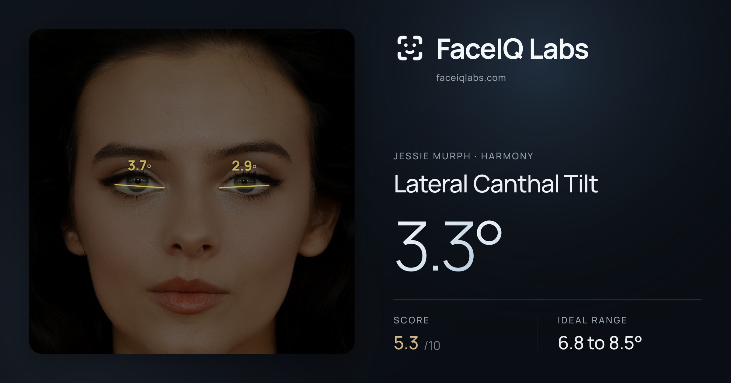 Jessie Murph Lateral Canthal Tilt: 3.3°, drawn on the photo