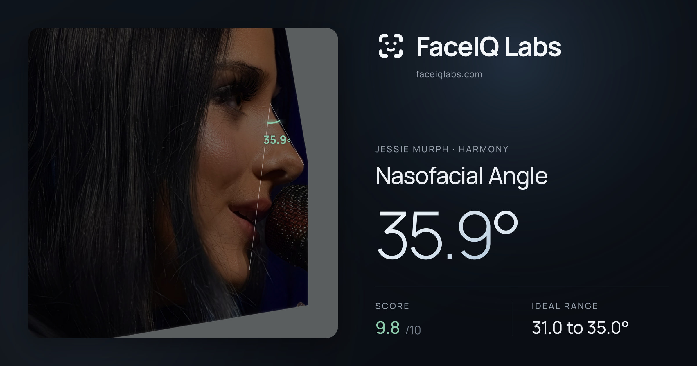 Jessie Murph Nasofacial Angle: 35.9°, drawn on the photo