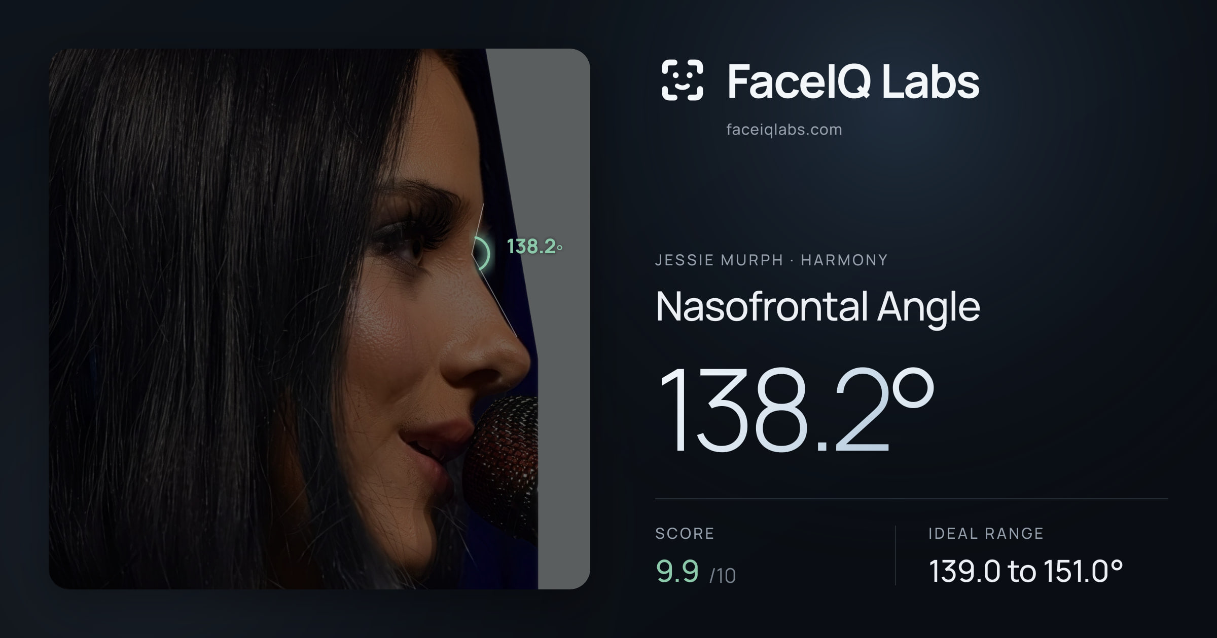 Jessie Murph Nasofrontal Angle: 138.2°, drawn on the photo