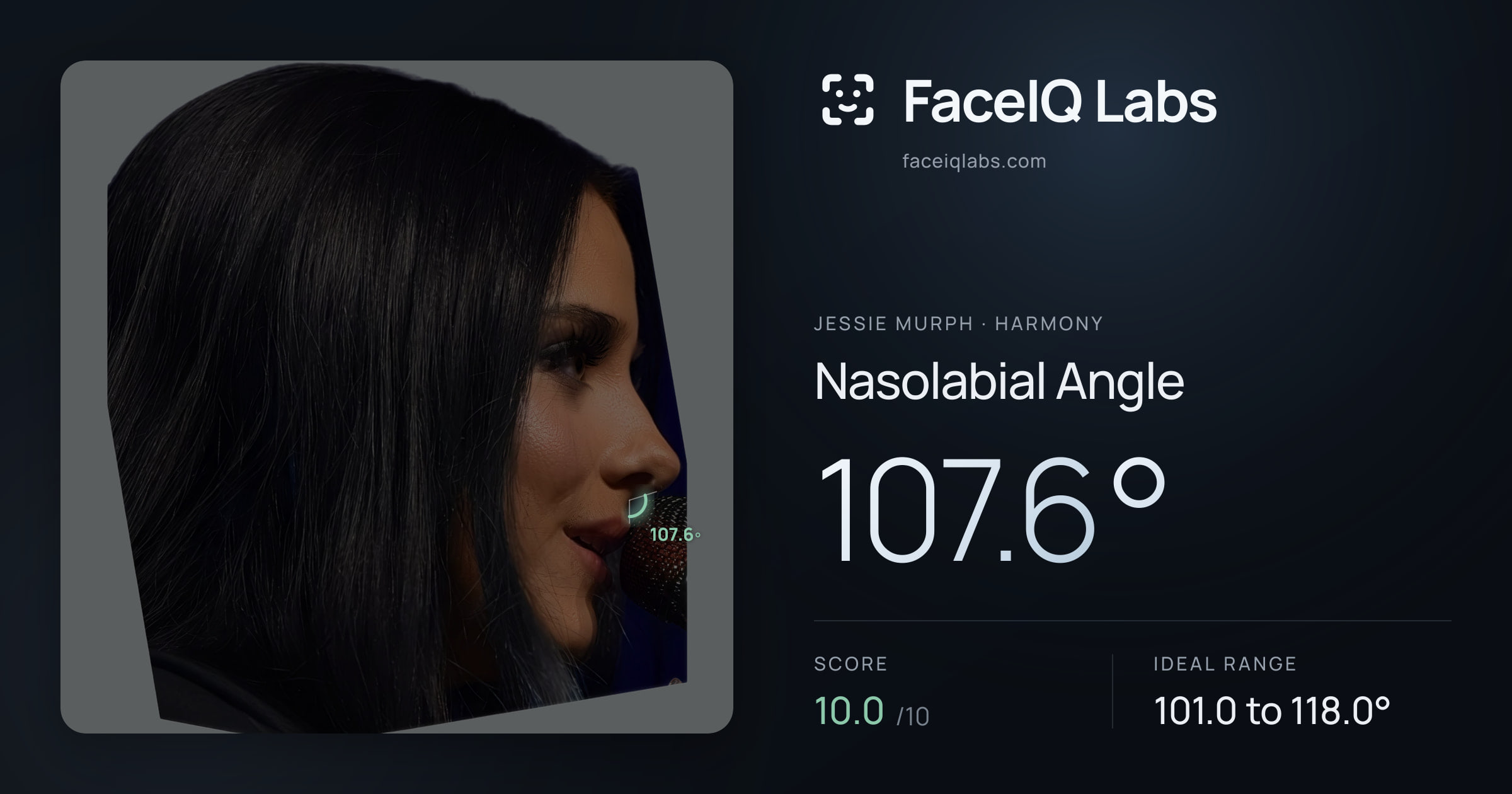Jessie Murph Nasolabial Angle: 107.6°, drawn on the photo