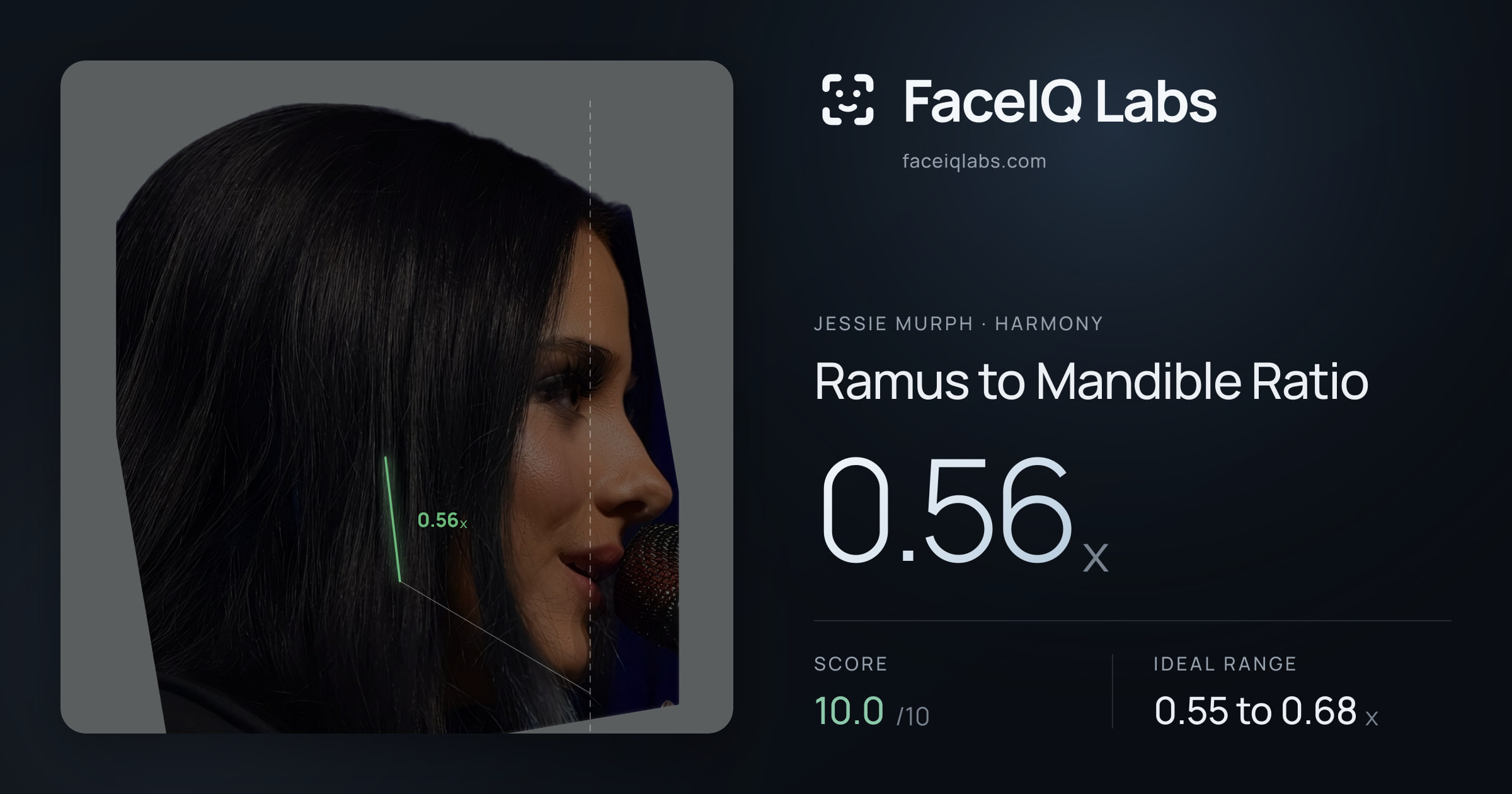 Jessie Murph Ramus to Mandible Ratio: 0.56x, drawn on the photo