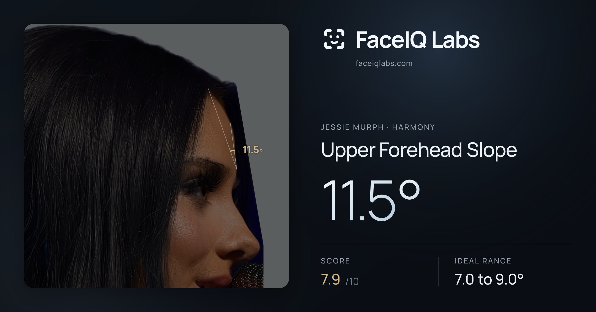 Jessie Murph Upper Forehead Slope: 11.5°, drawn on the photo