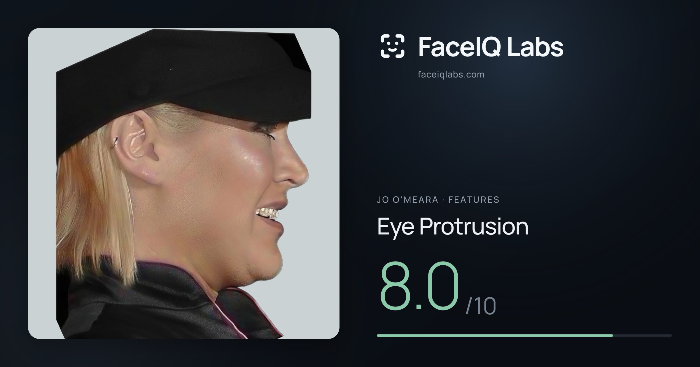 Jo O'Meara Eye Protrusion: 8.0/10, drawn on the photo
