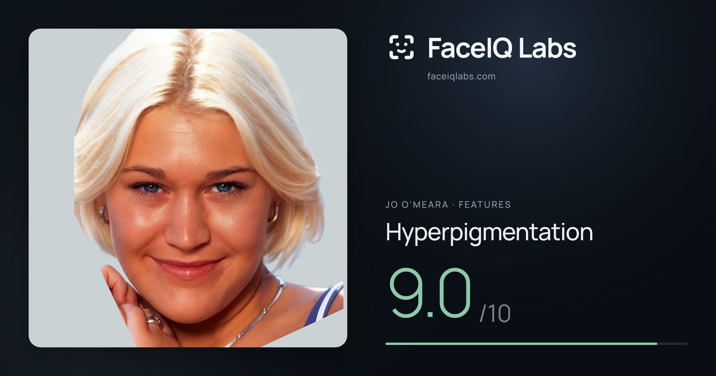 Jo O'Meara Hyperpigmentation: 9.0/10, drawn on the photo