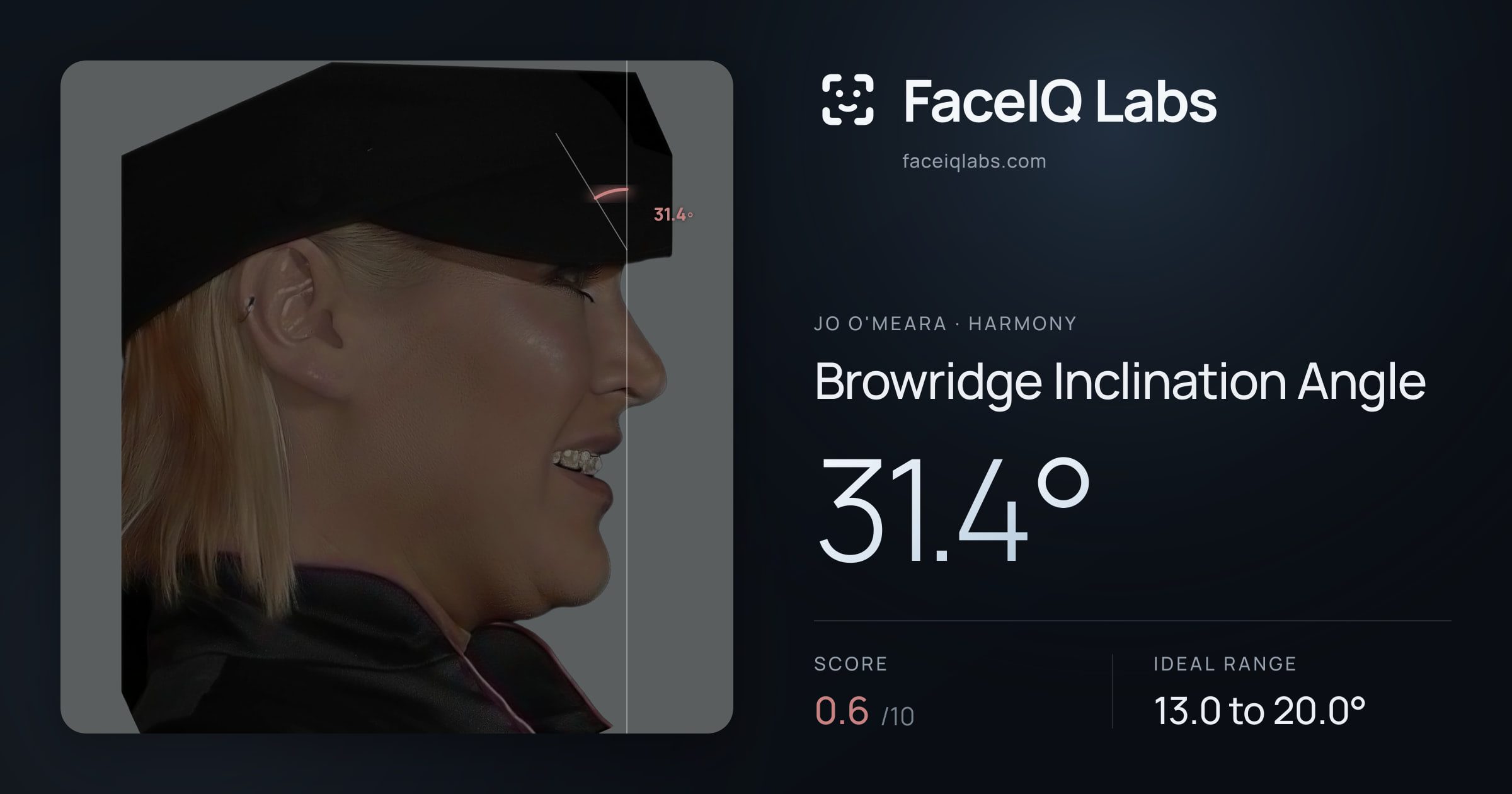 Jo O'Meara Browridge Inclination Angle: 31.4°, drawn on the photo