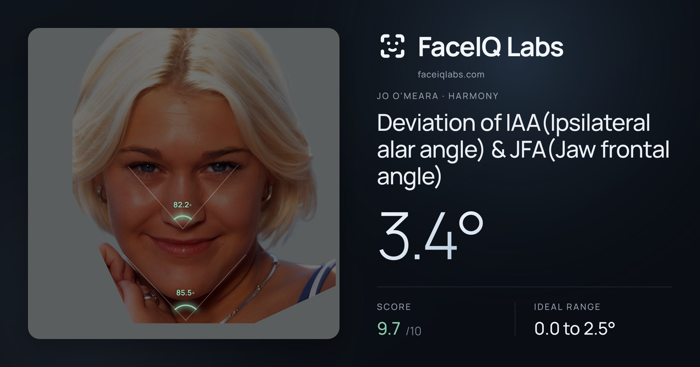 Jo O'Meara Deviation of IAA(Ipsilateral alar angle) & JFA(Jaw frontal angle): 3.4°, drawn on the photo