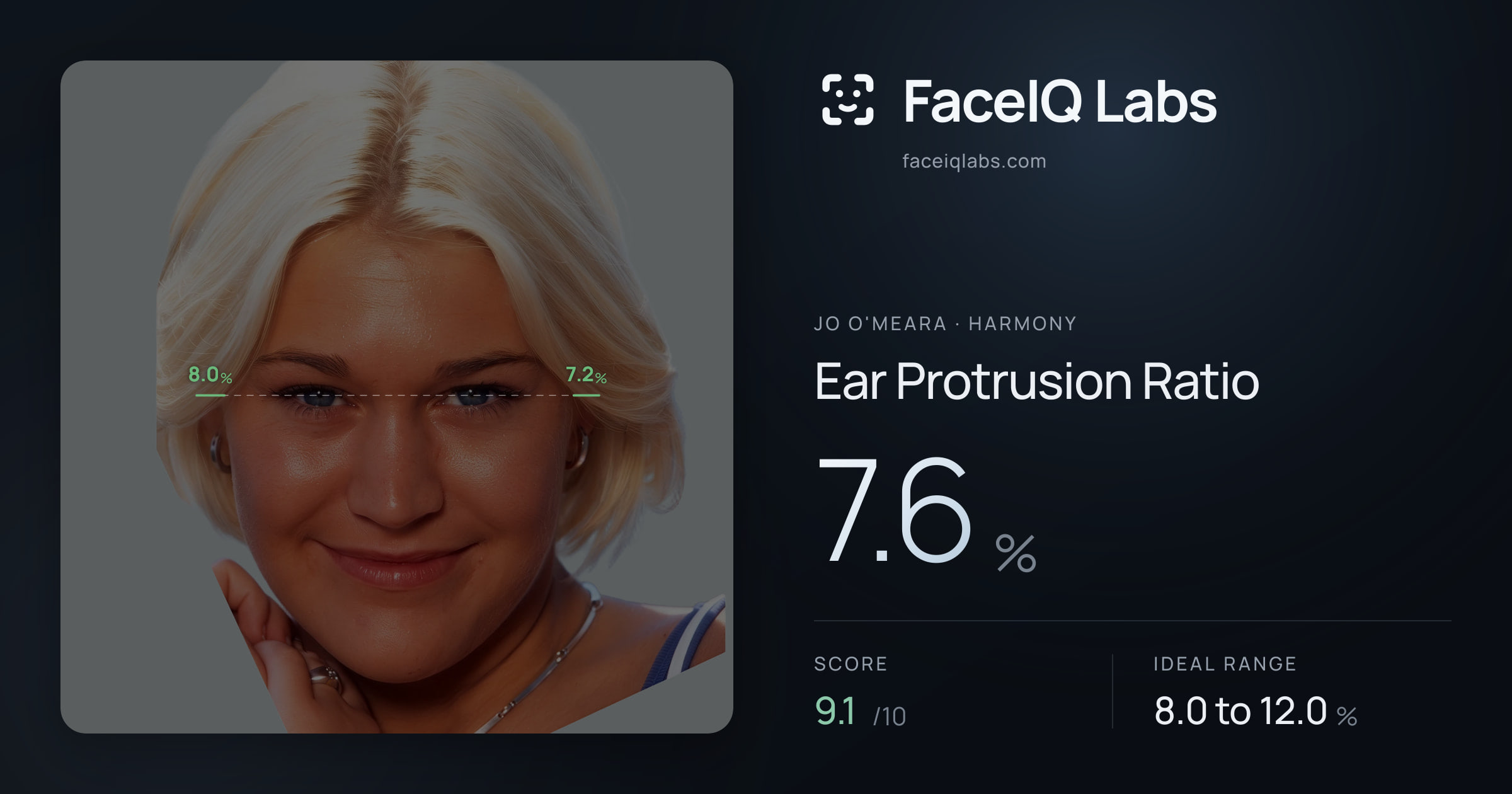 Jo O'Meara Ear Protrusion Ratio: 7.6%, drawn on the photo