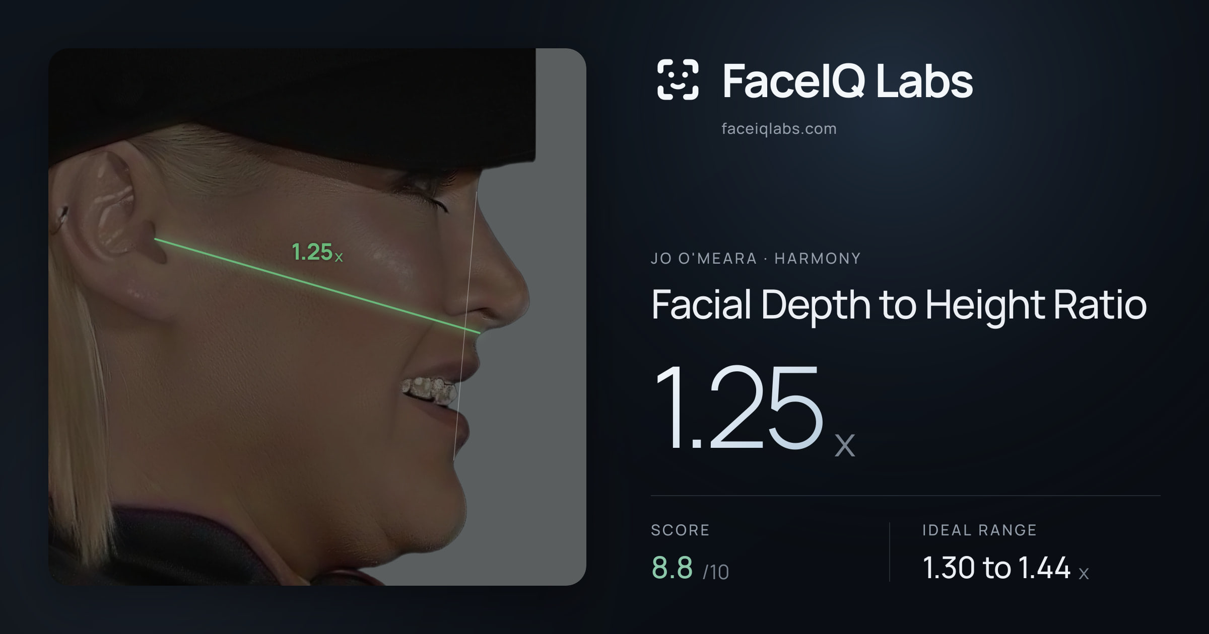 Jo O'Meara Facial Depth to Height Ratio: 1.25x, drawn on the photo