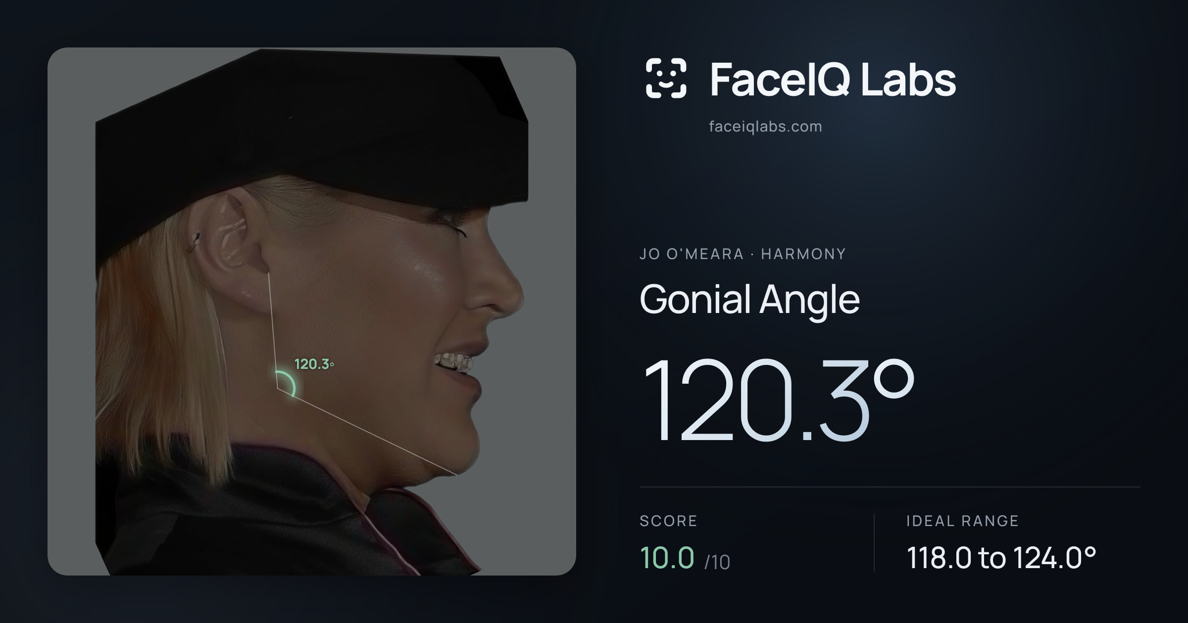 Jo O'Meara Gonial Angle: 120.3°, drawn on the photo