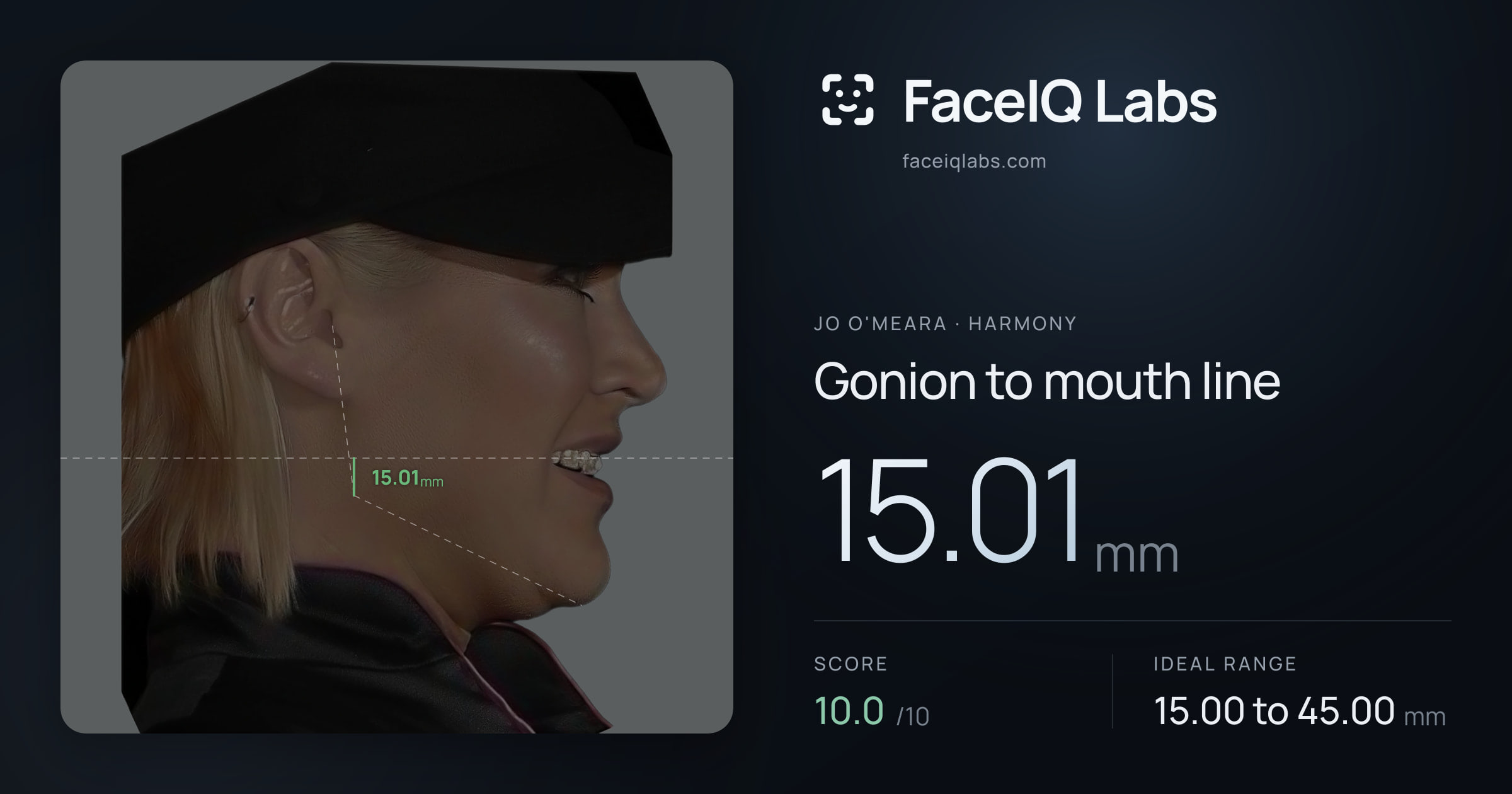 Jo O'Meara Gonion to mouth line: 15.01mm, drawn on the photo