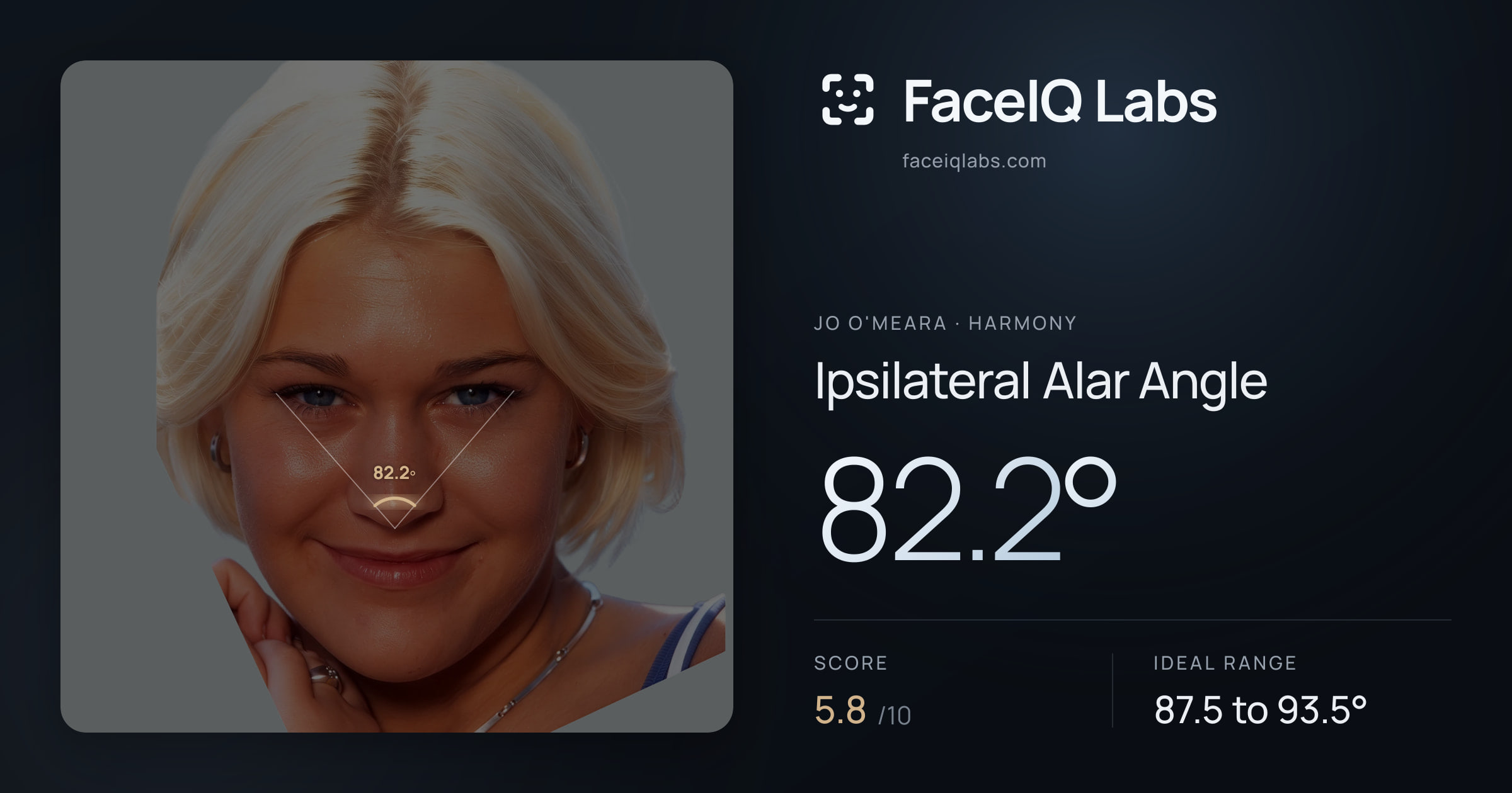 Jo O'Meara Ipsilateral Alar Angle: 82.2°, drawn on the photo