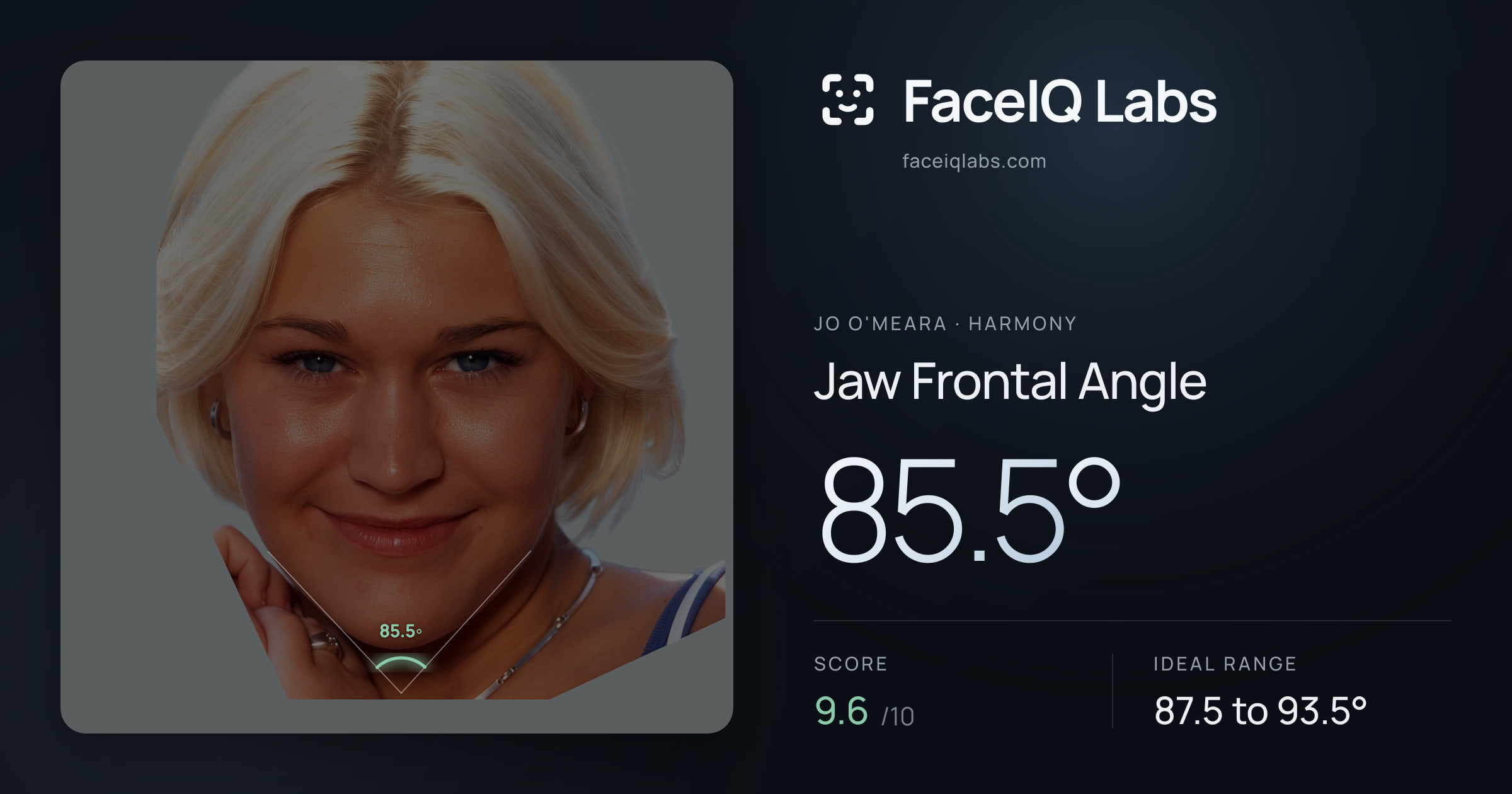 Jo O'Meara Jaw Frontal Angle: 85.5°, drawn on the photo