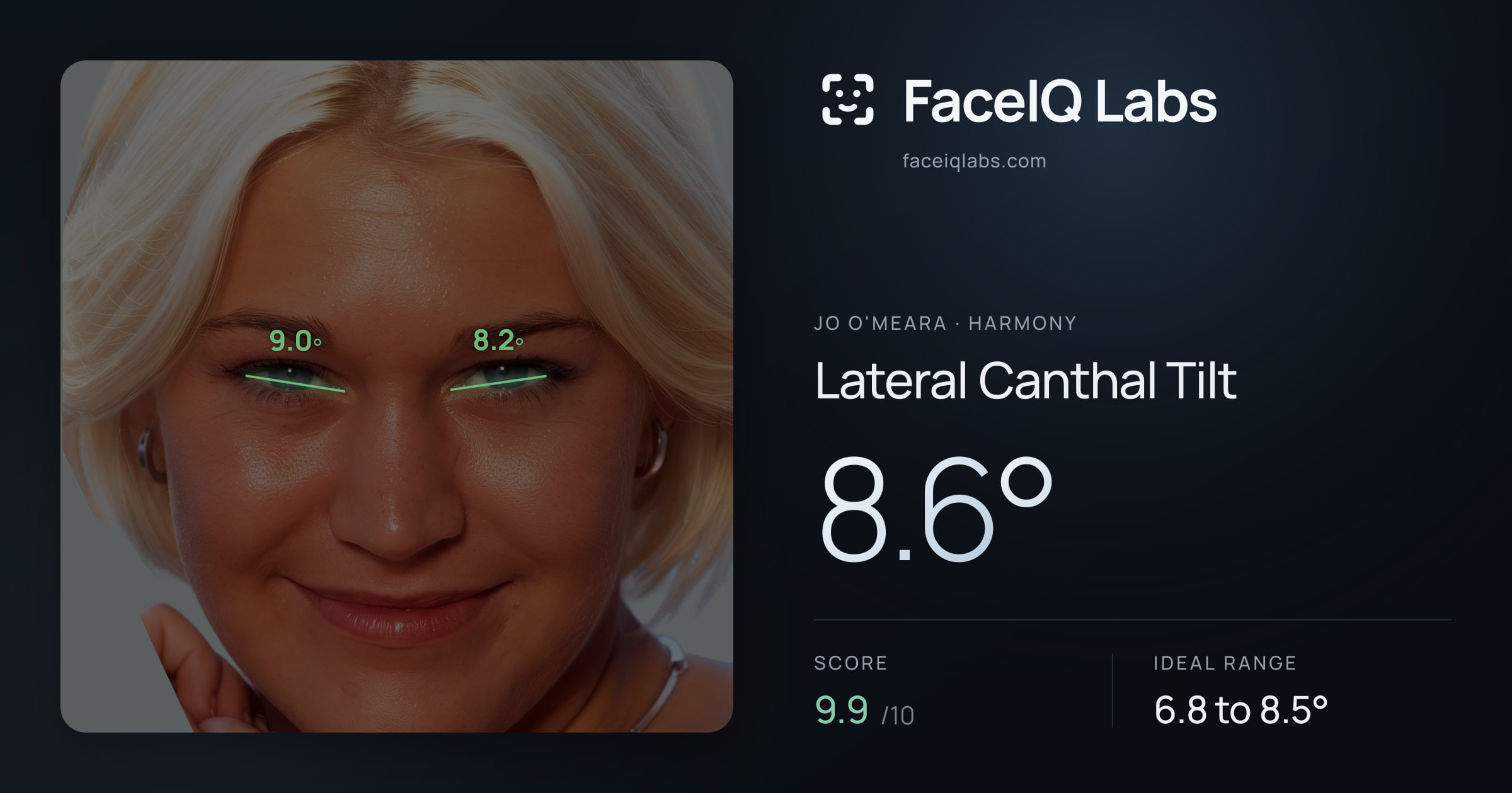 Jo O'Meara Lateral Canthal Tilt: 8.6°, drawn on the photo