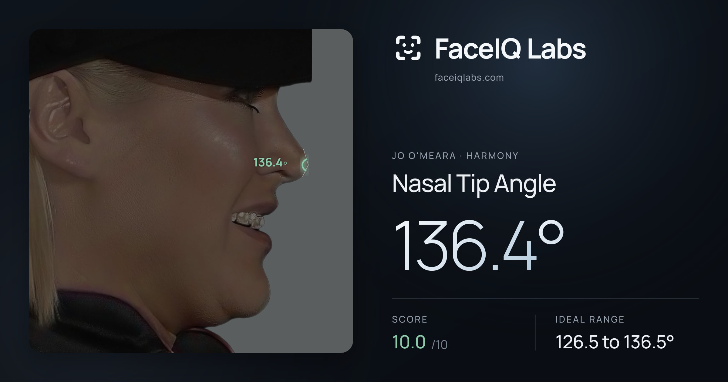 Jo O'Meara Nasal Tip Angle: 136.4°, drawn on the photo