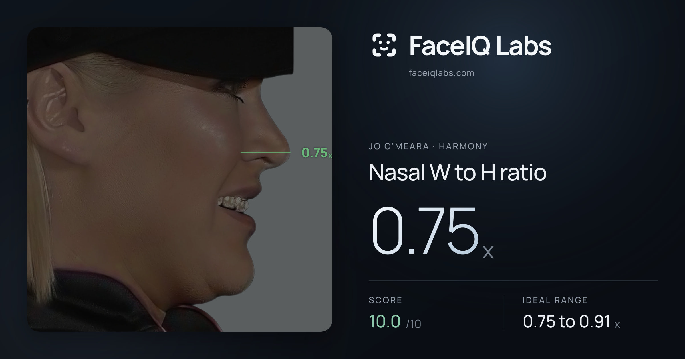 Jo O'Meara Nasal W to H ratio: 0.75x, drawn on the photo