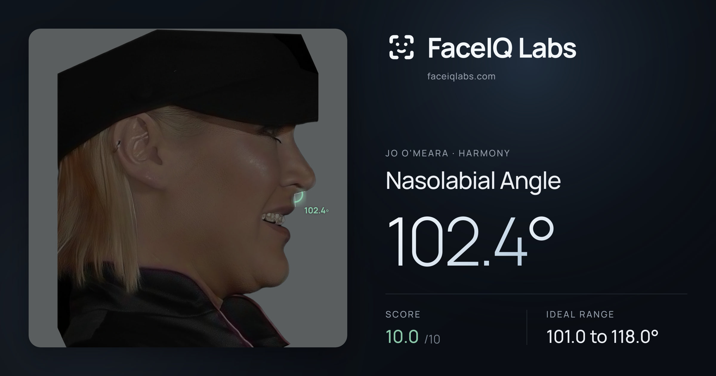 Jo O'Meara Nasolabial Angle: 102.4°, drawn on the photo