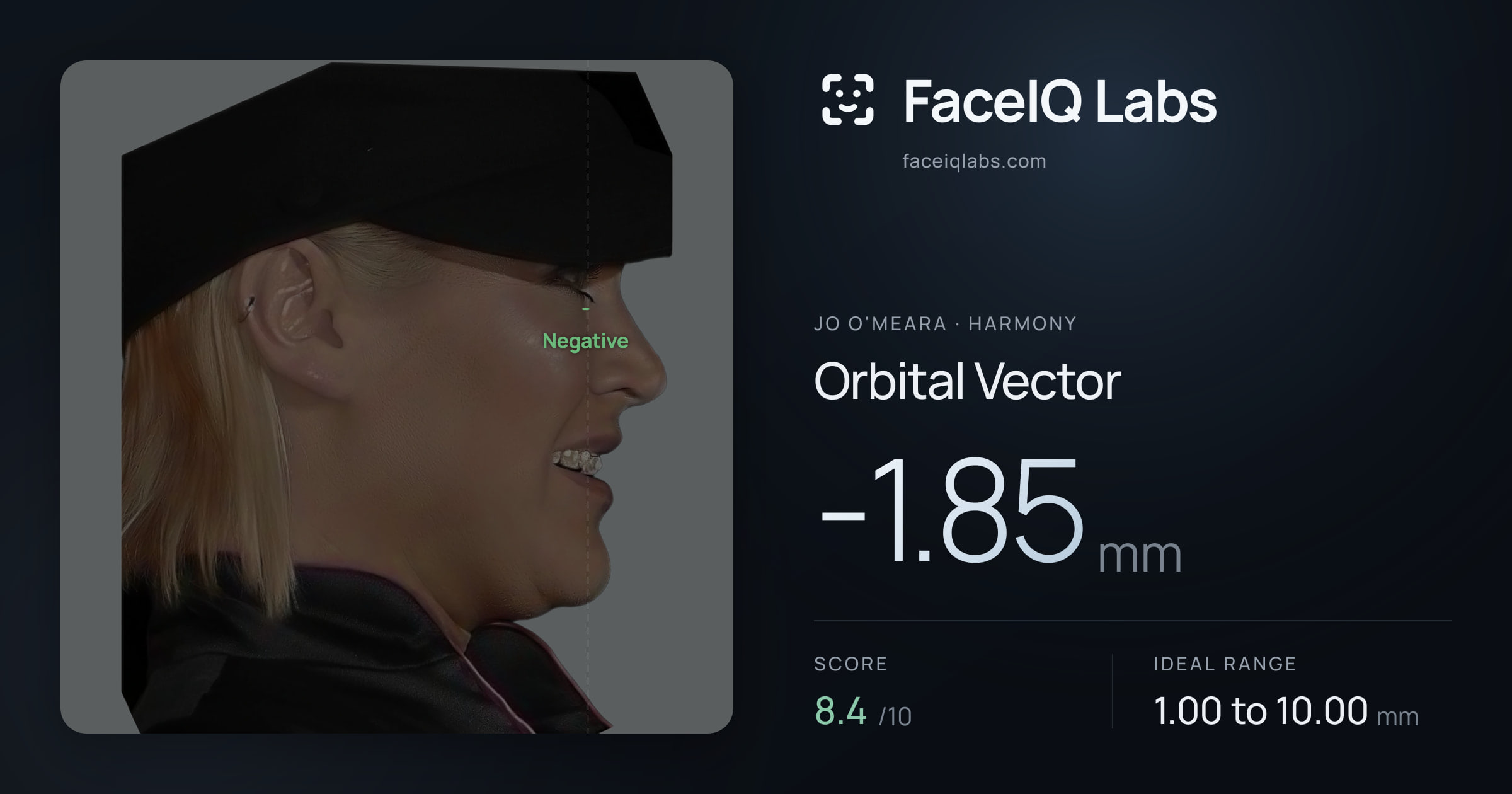 Jo O'Meara Orbital Vector: -1.85mm, drawn on the photo