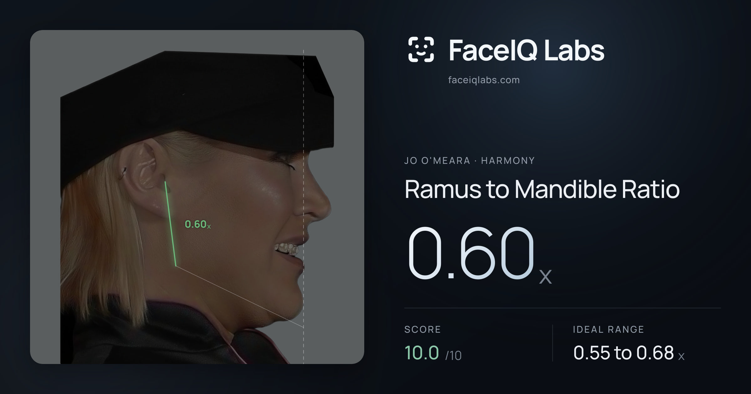 Jo O'Meara Ramus to Mandible Ratio: 0.60x, drawn on the photo